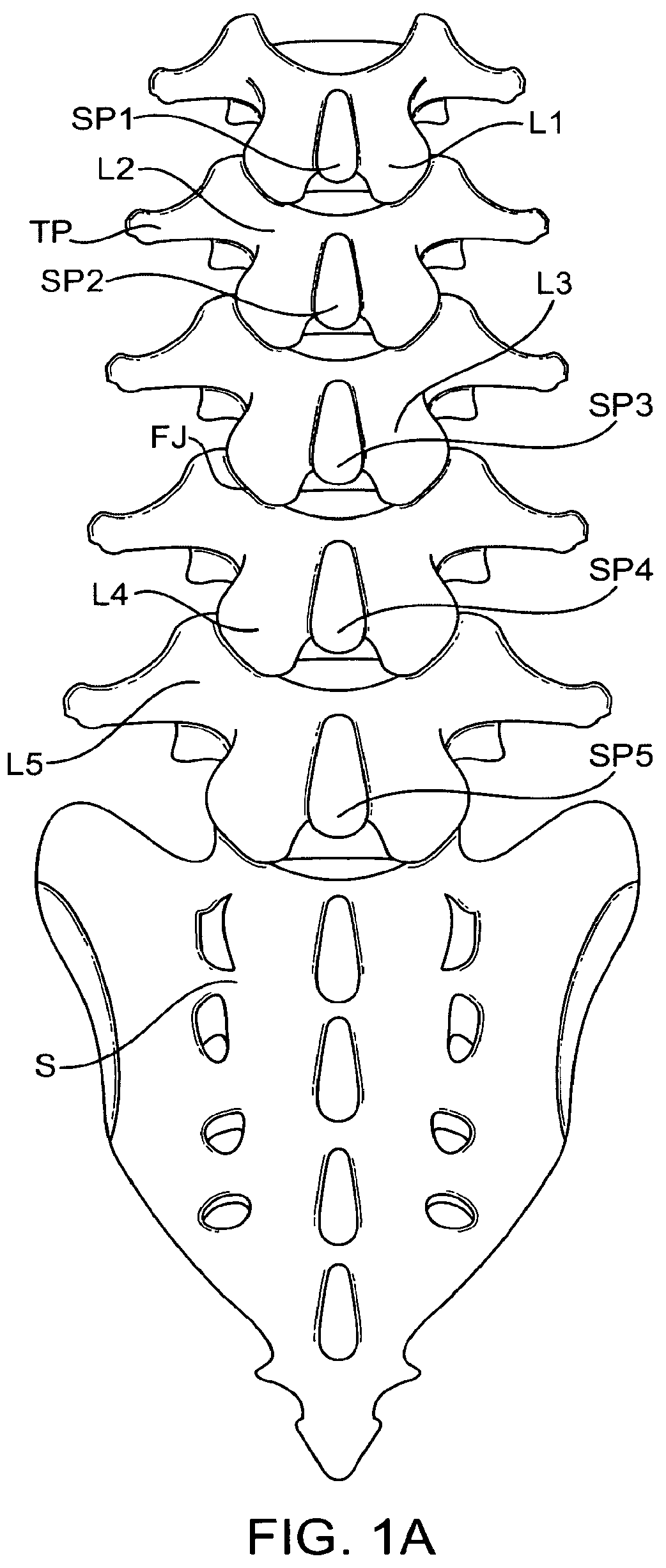 Patent US12167874 Figure 1 – Surgical tether apparatus and methods of use