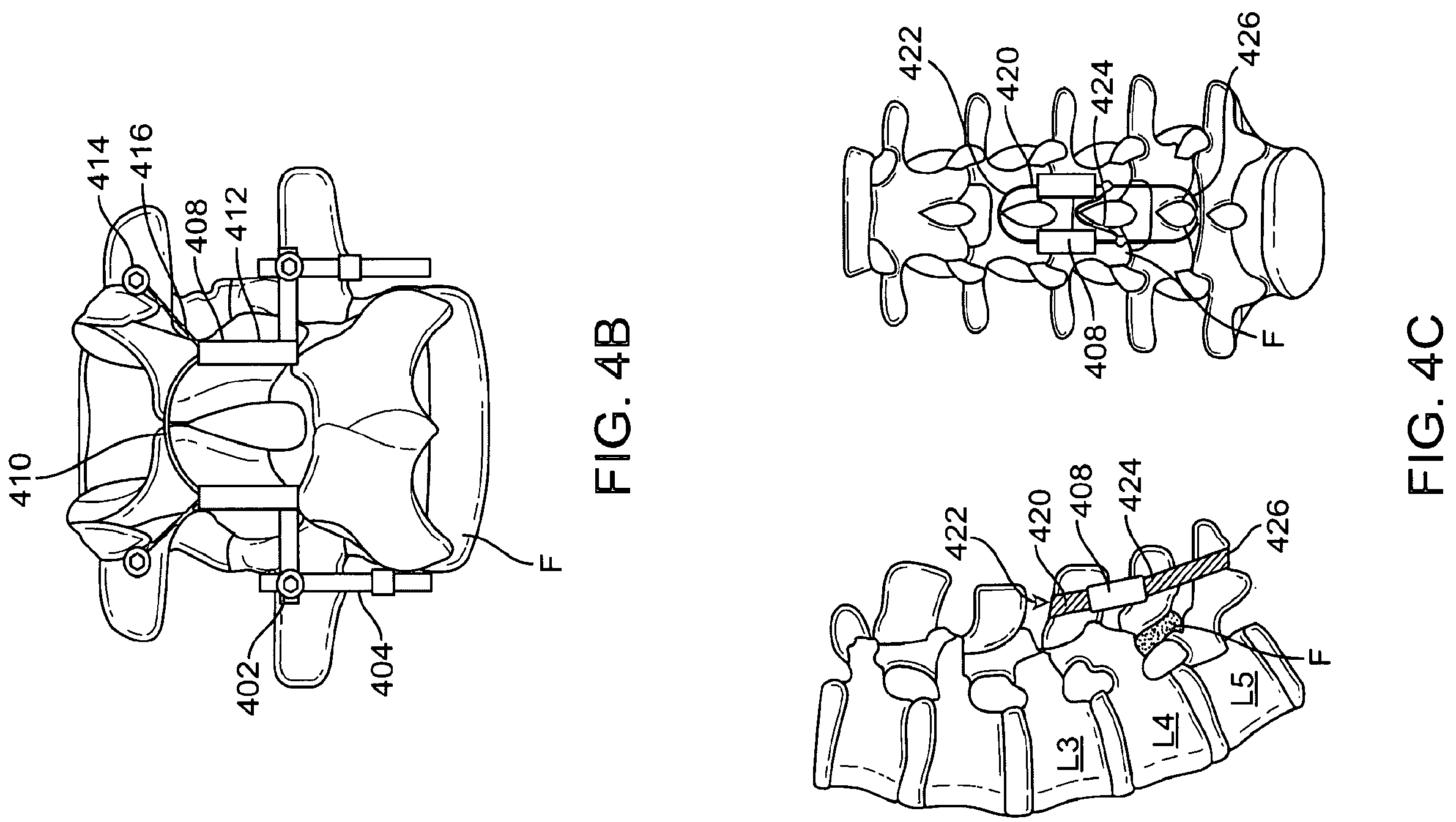 Patent US12167874 Figure 6 – Surgical tether apparatus and methods of use