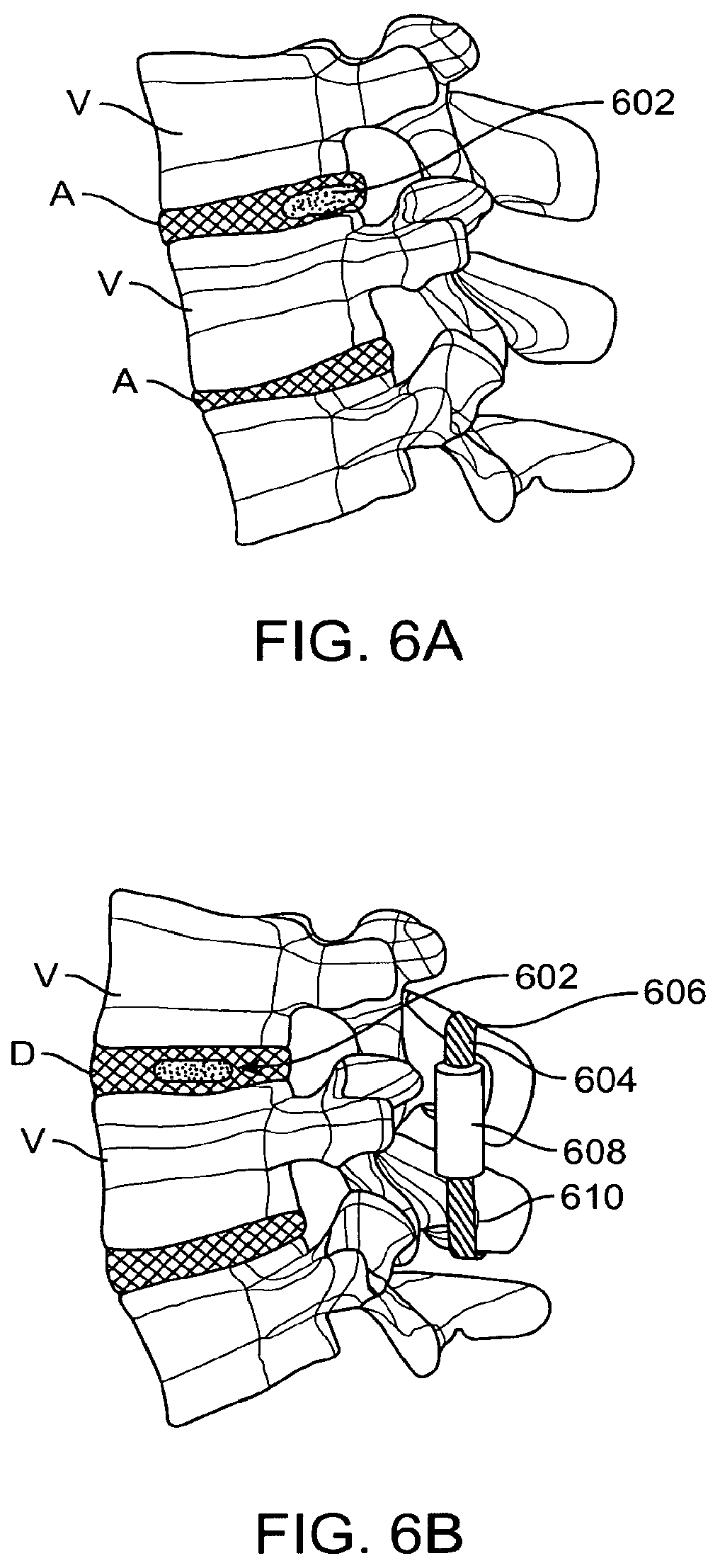 Patent US12167874 Figure 8 – Surgical tether apparatus and methods of use