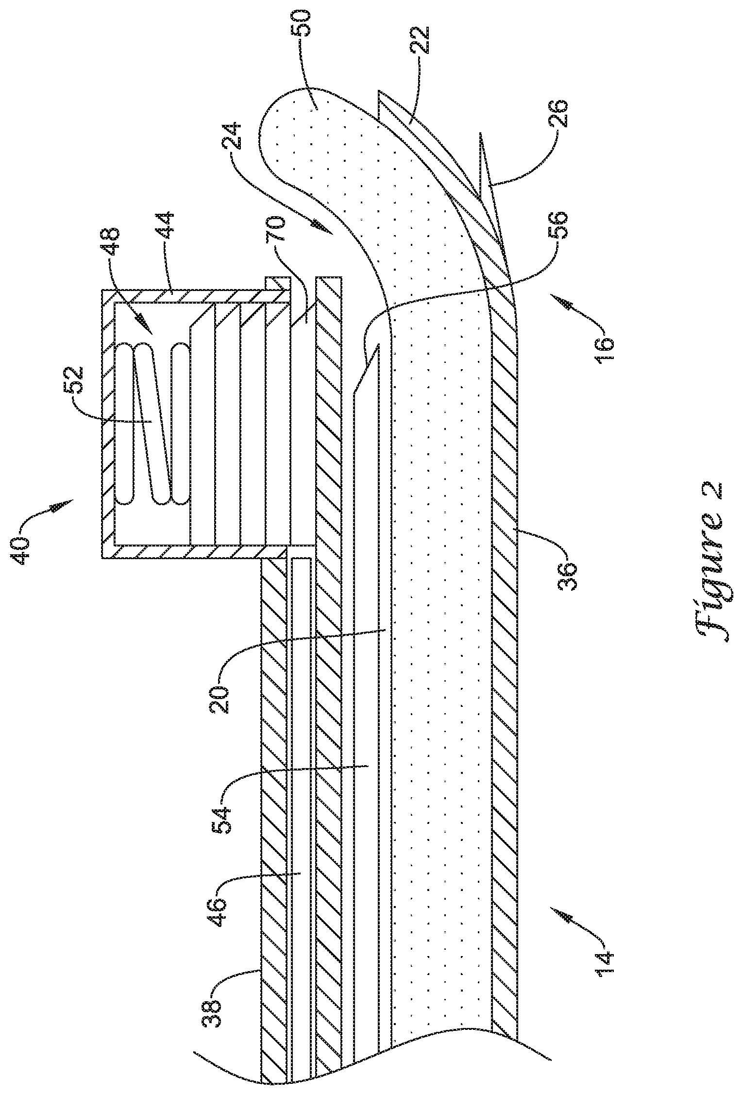 Patent US12167875 Figure 2 – Spinal stabilization installation instrumentation and methods