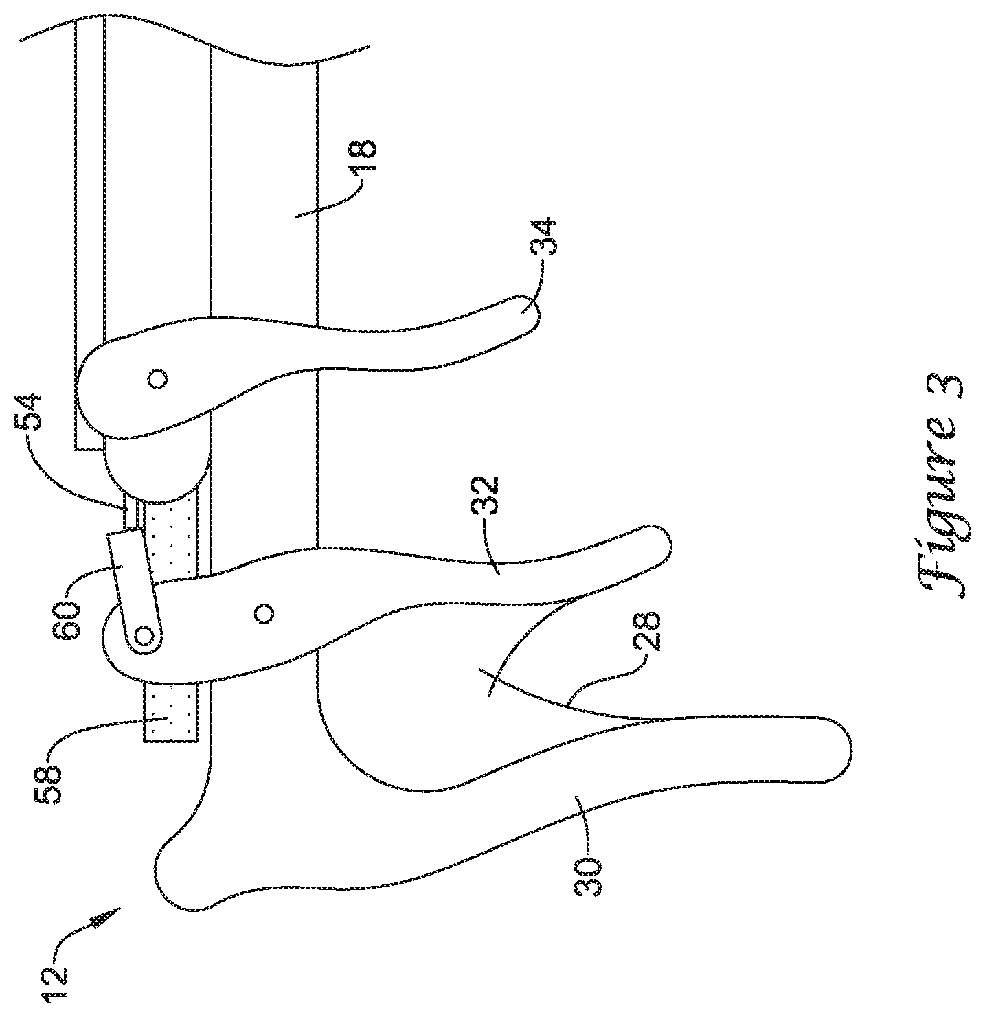 Patent US12167875 Figure 3 – Spinal stabilization installation instrumentation and methods