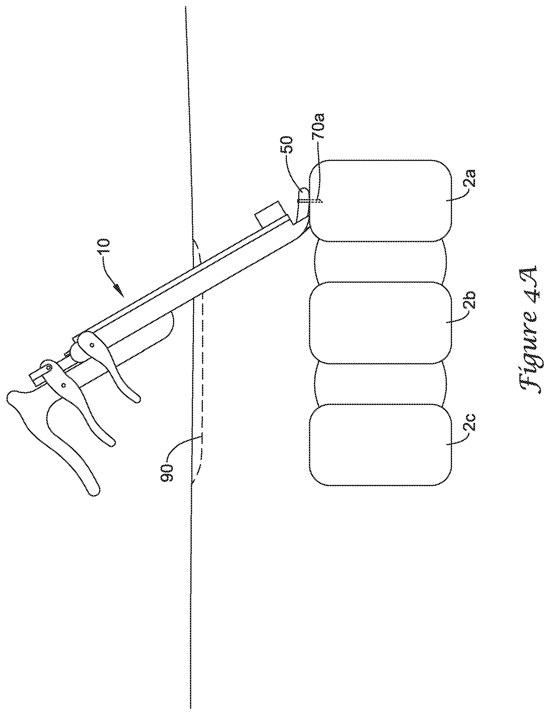 Patent US12167875 Figure 4 – Spinal stabilization installation instrumentation and methods