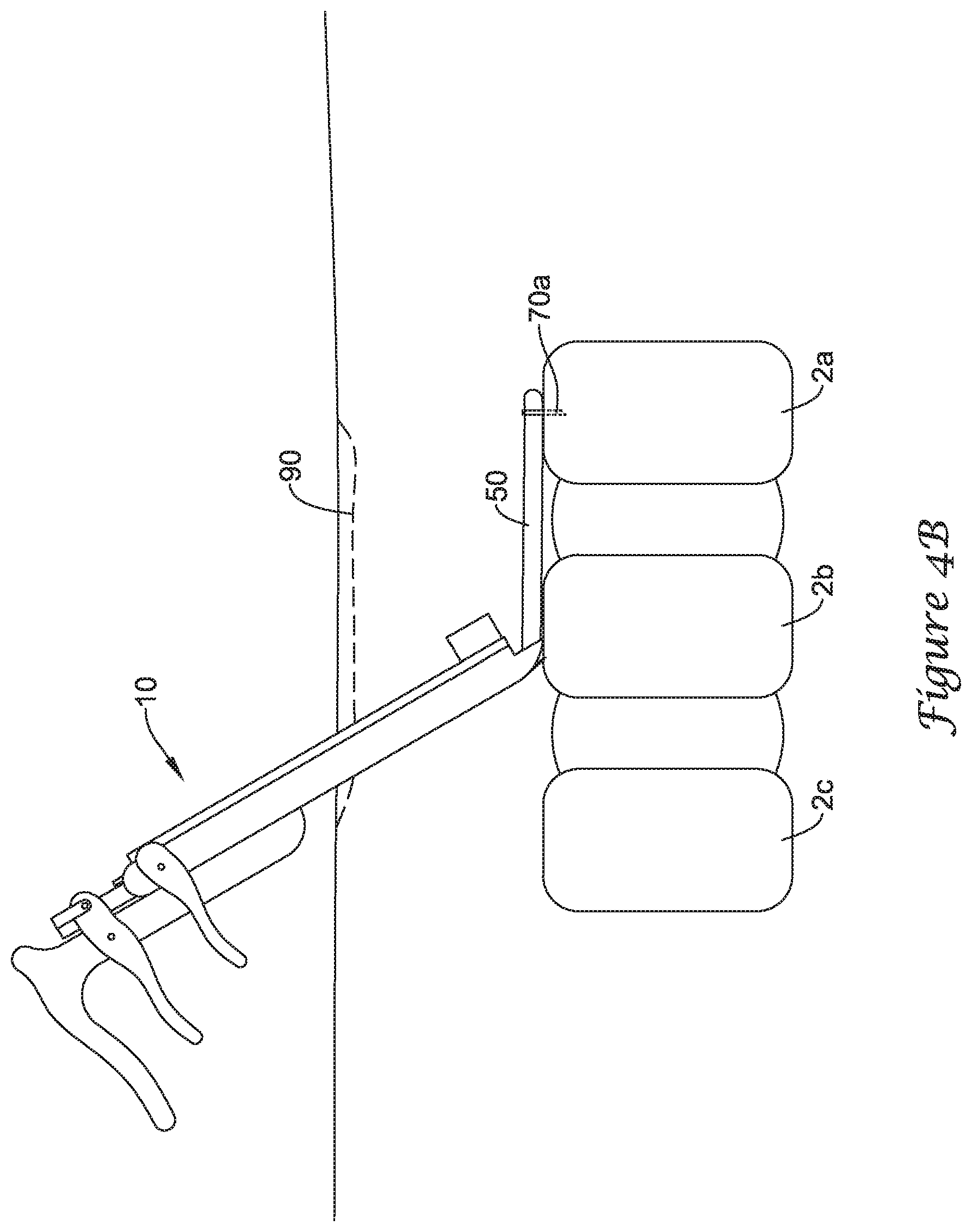 Patent US12167875 Figure 5 – Spinal stabilization installation instrumentation and methods
