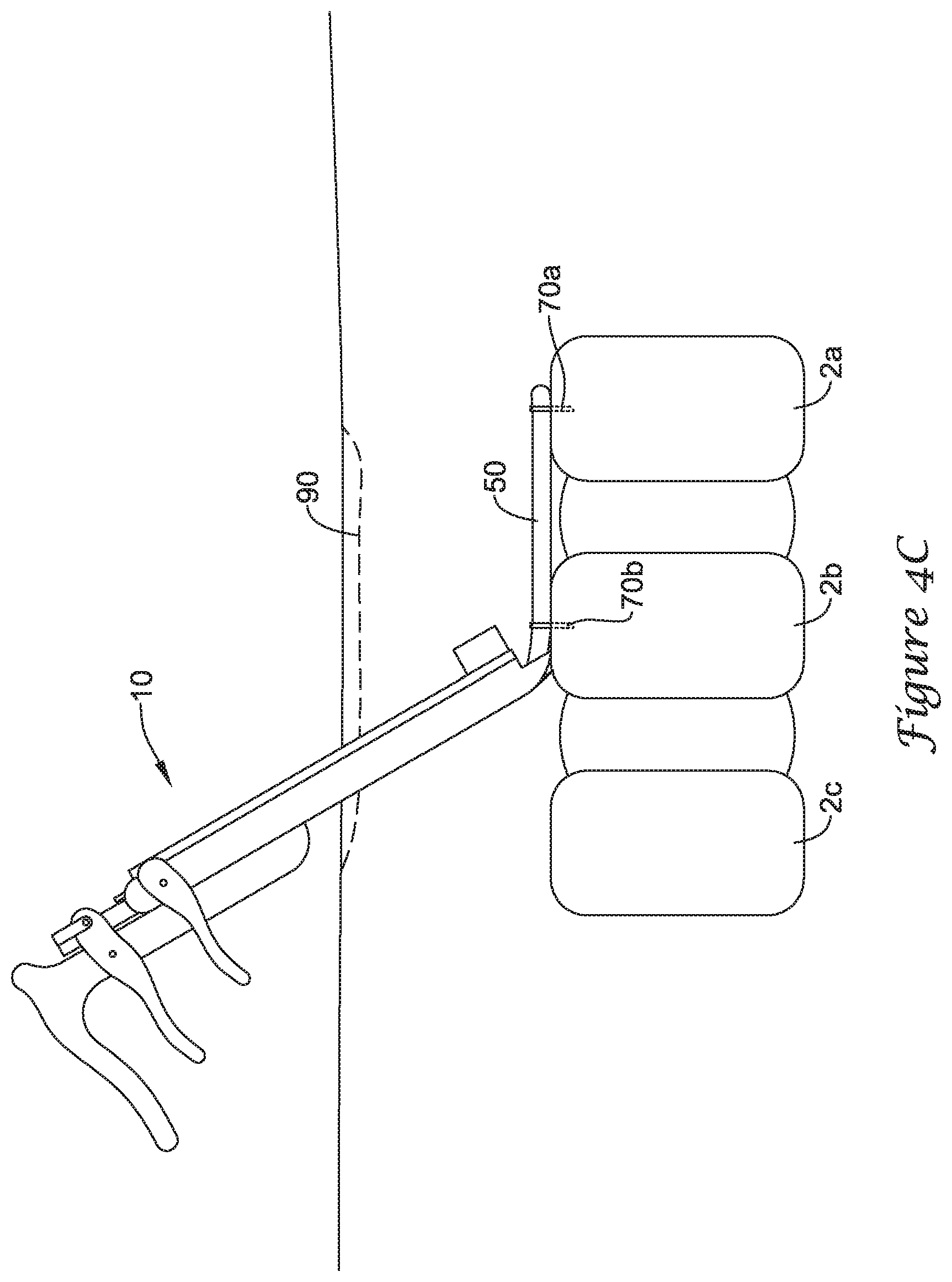 Patent US12167875 Figure 6 – Spinal stabilization installation instrumentation and methods