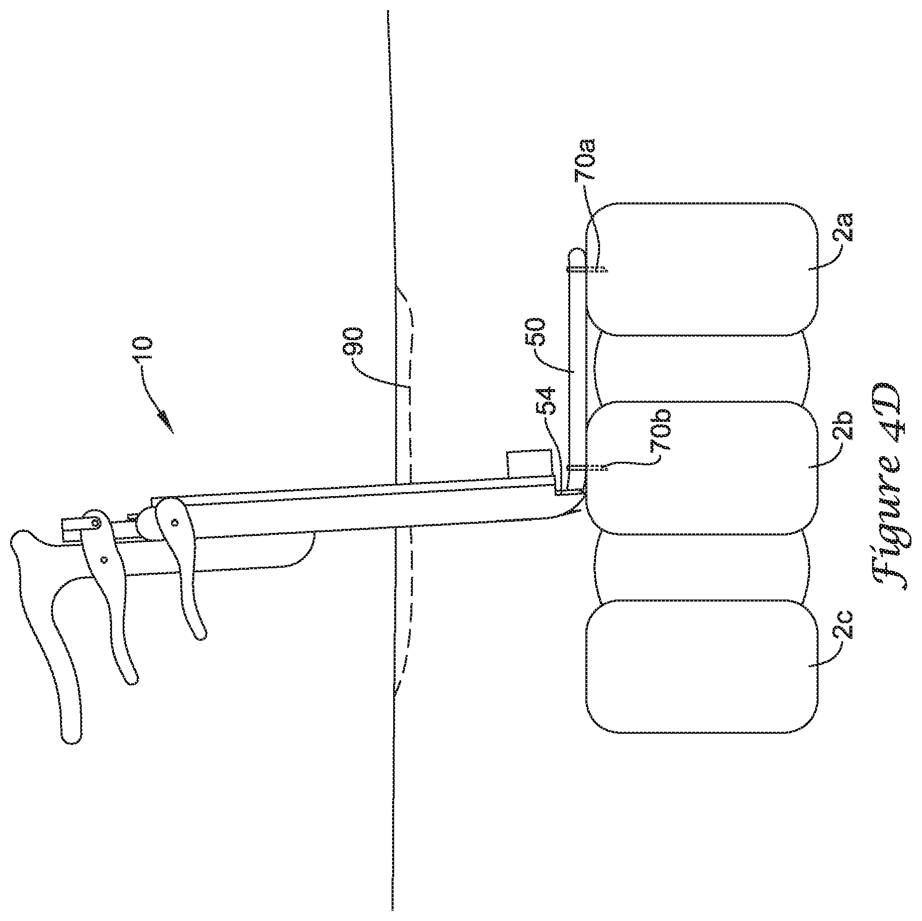 Patent US12167875 Figure 7 – Spinal stabilization installation instrumentation and methods