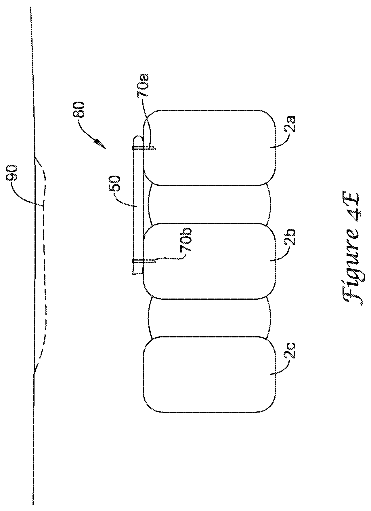Patent US12167875 Figure 8 – Spinal stabilization installation instrumentation and methods