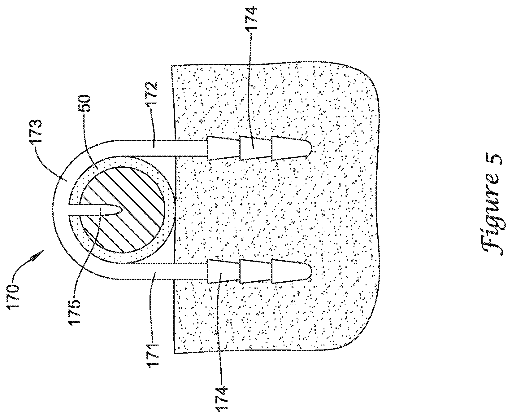 Patent US12167875 Figure 9 – Spinal stabilization installation instrumentation and methods