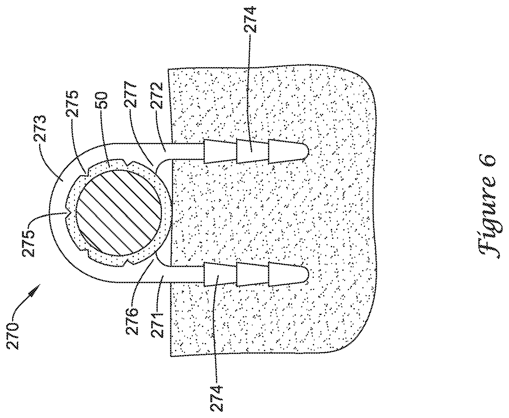 Patent US12167875 Figure 10 – Spinal stabilization installation instrumentation and methods