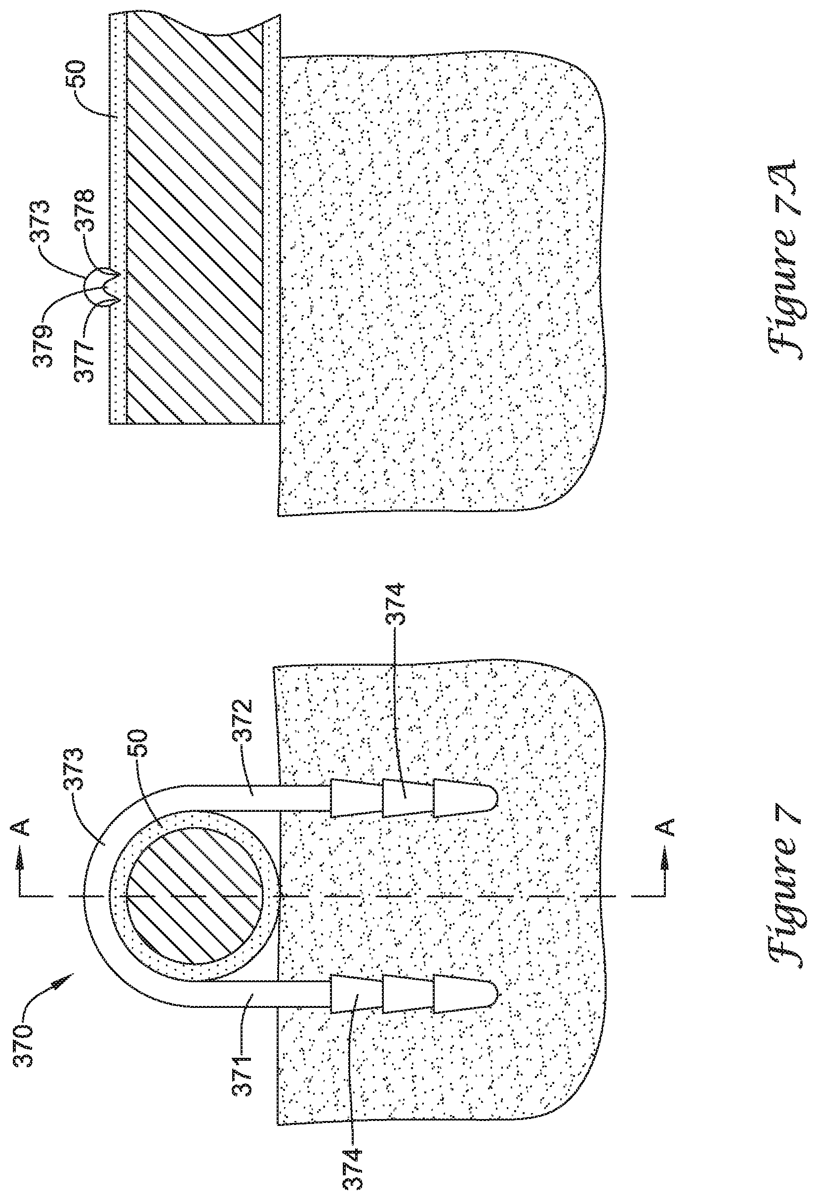Patent US12167875 Figure 11 – Spinal stabilization installation instrumentation and methods