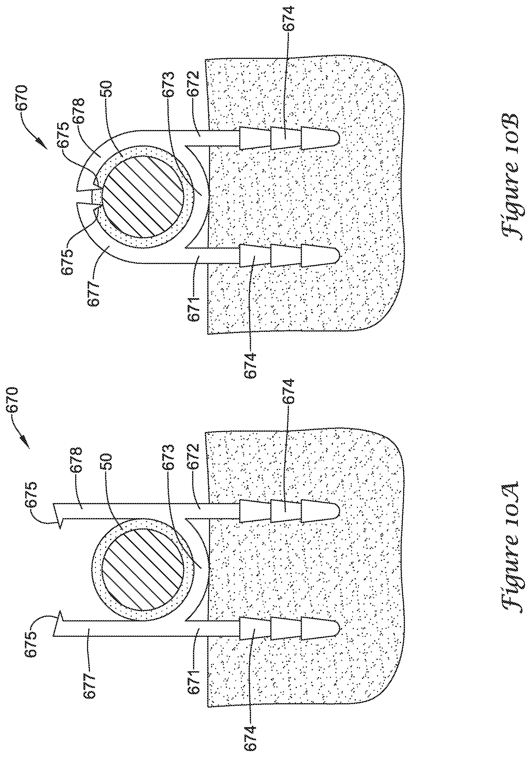 Patent US12167875 Figure 14 – Spinal stabilization installation instrumentation and methods
