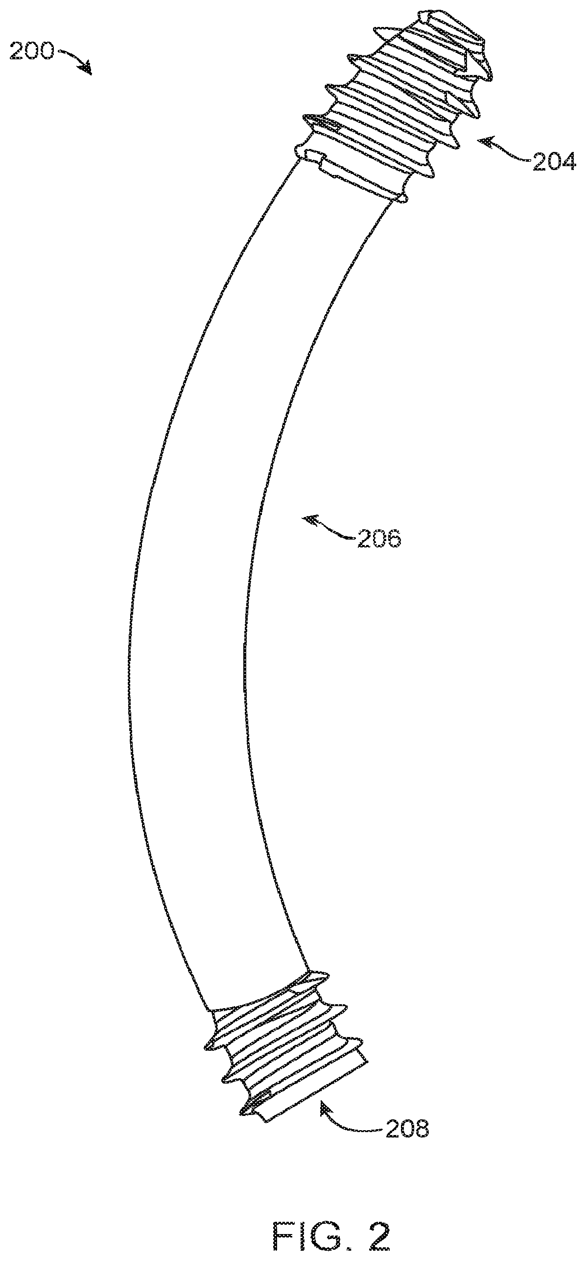Patent US12167877 Figure 3 – Shape adaptable intramedullary fixation device