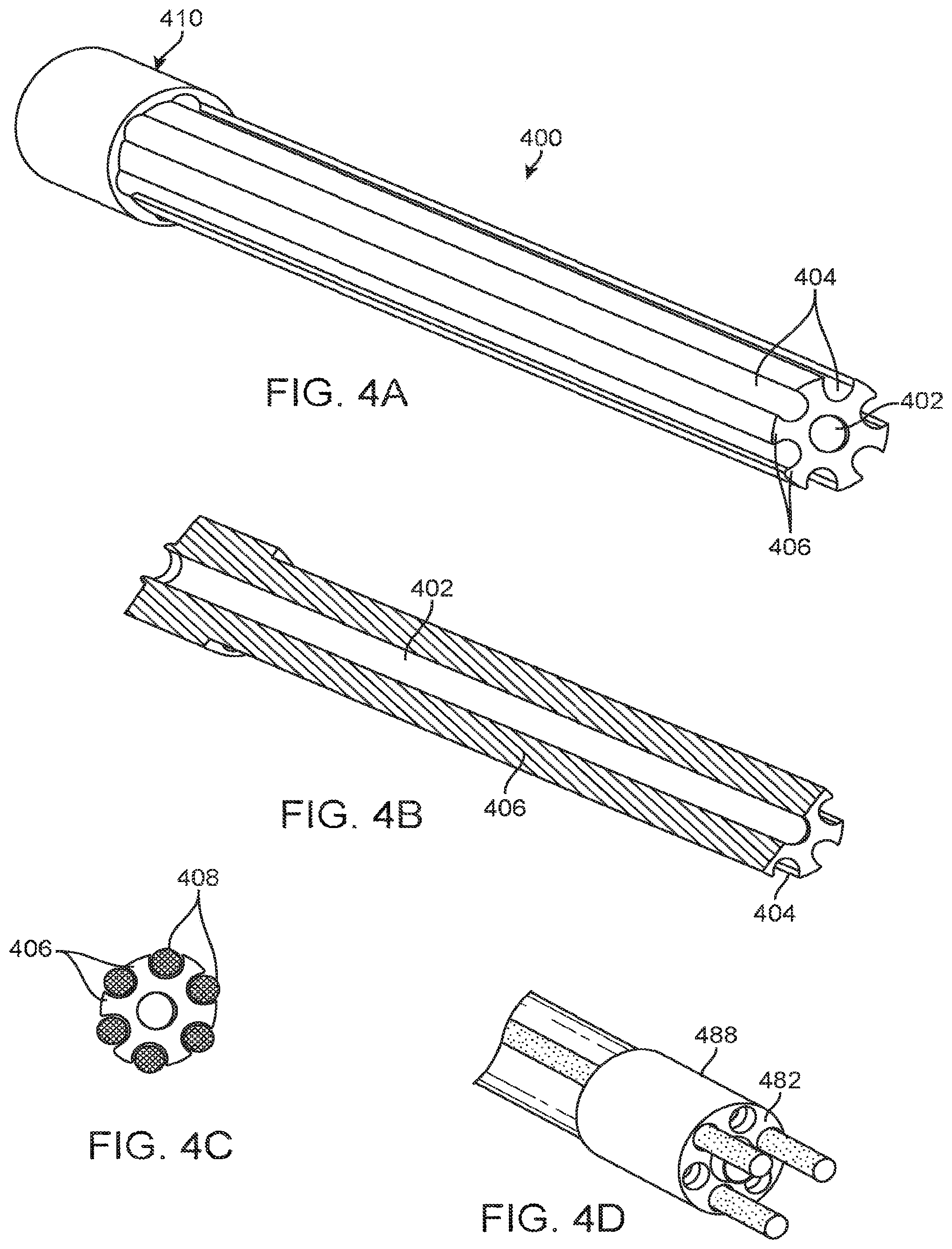 Patent US12167877 Figure 5 – Shape adaptable intramedullary fixation device
