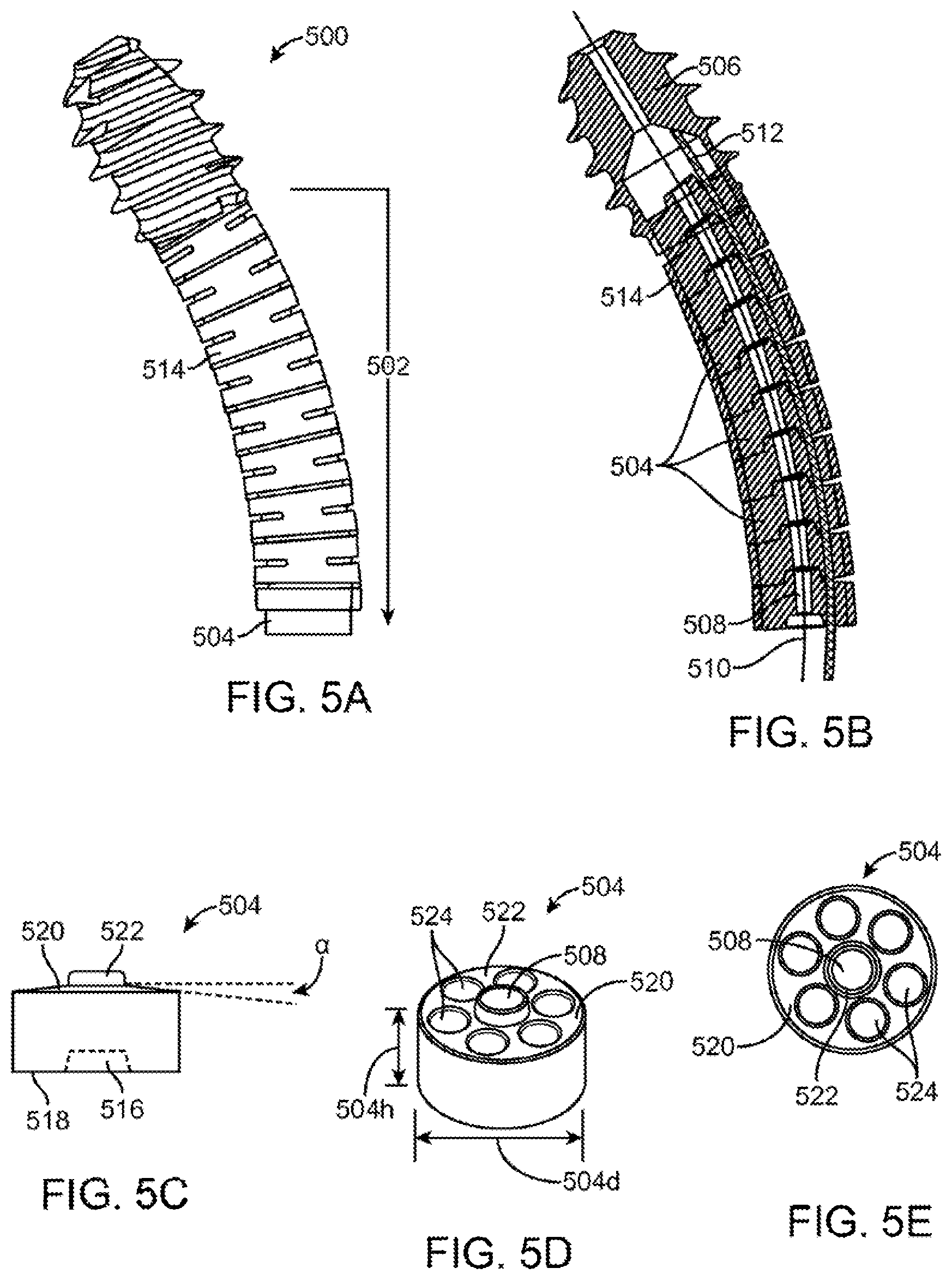 Patent US12167877 Figure 6 – Shape adaptable intramedullary fixation device