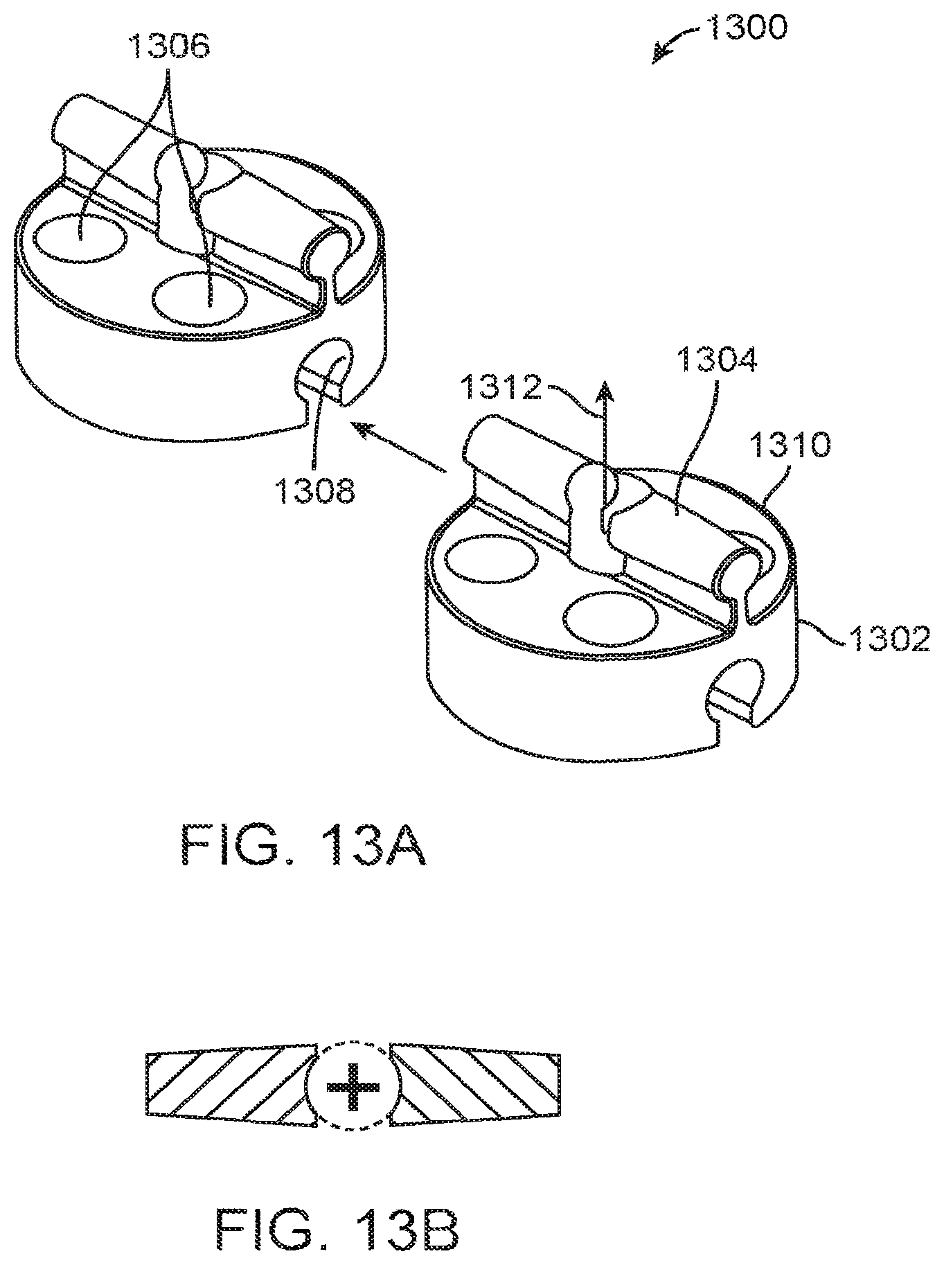 Patent US12167877 Figure 13 – Shape adaptable intramedullary fixation device