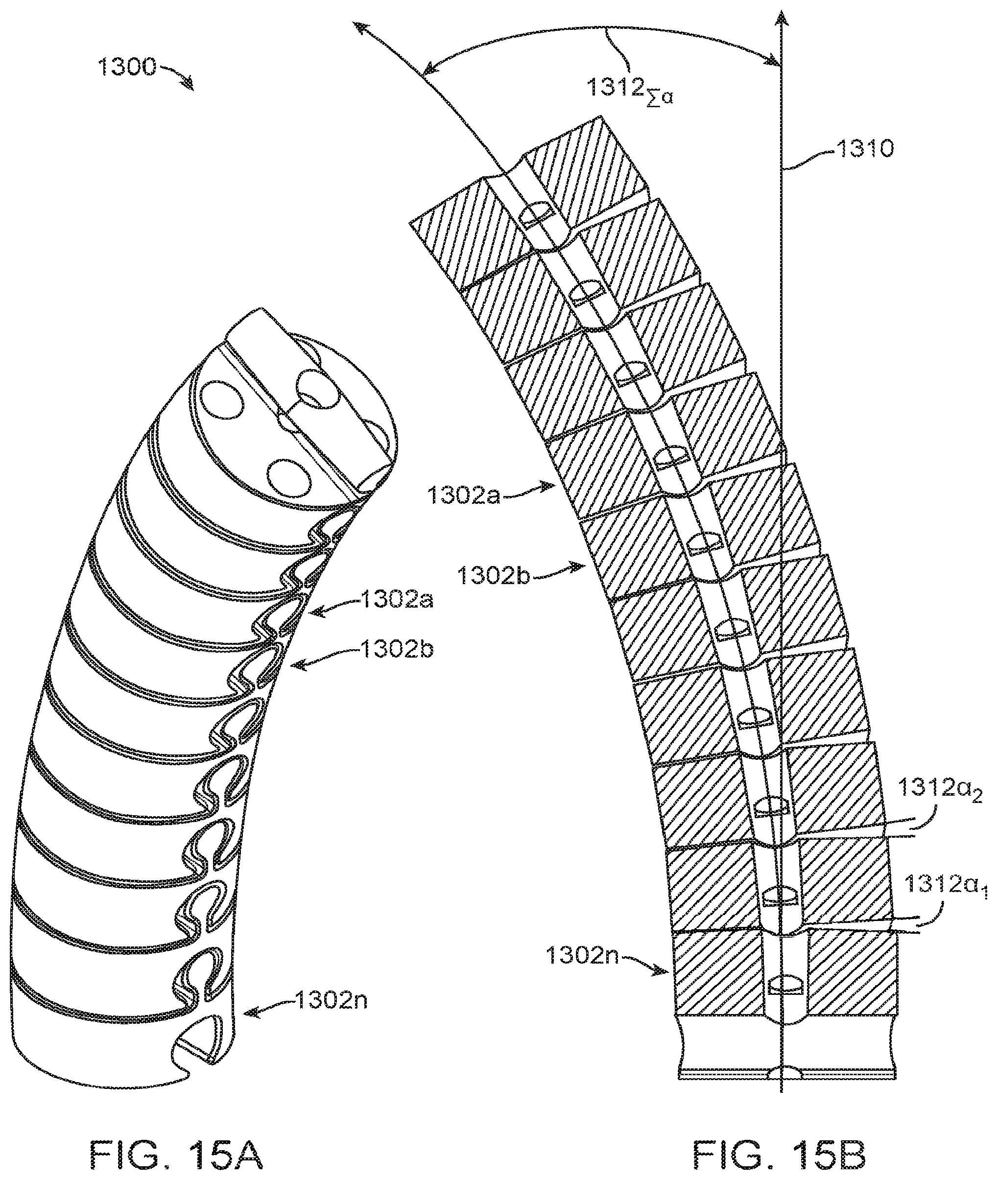 Patent US12167877 Figure 15 – Shape adaptable intramedullary fixation device