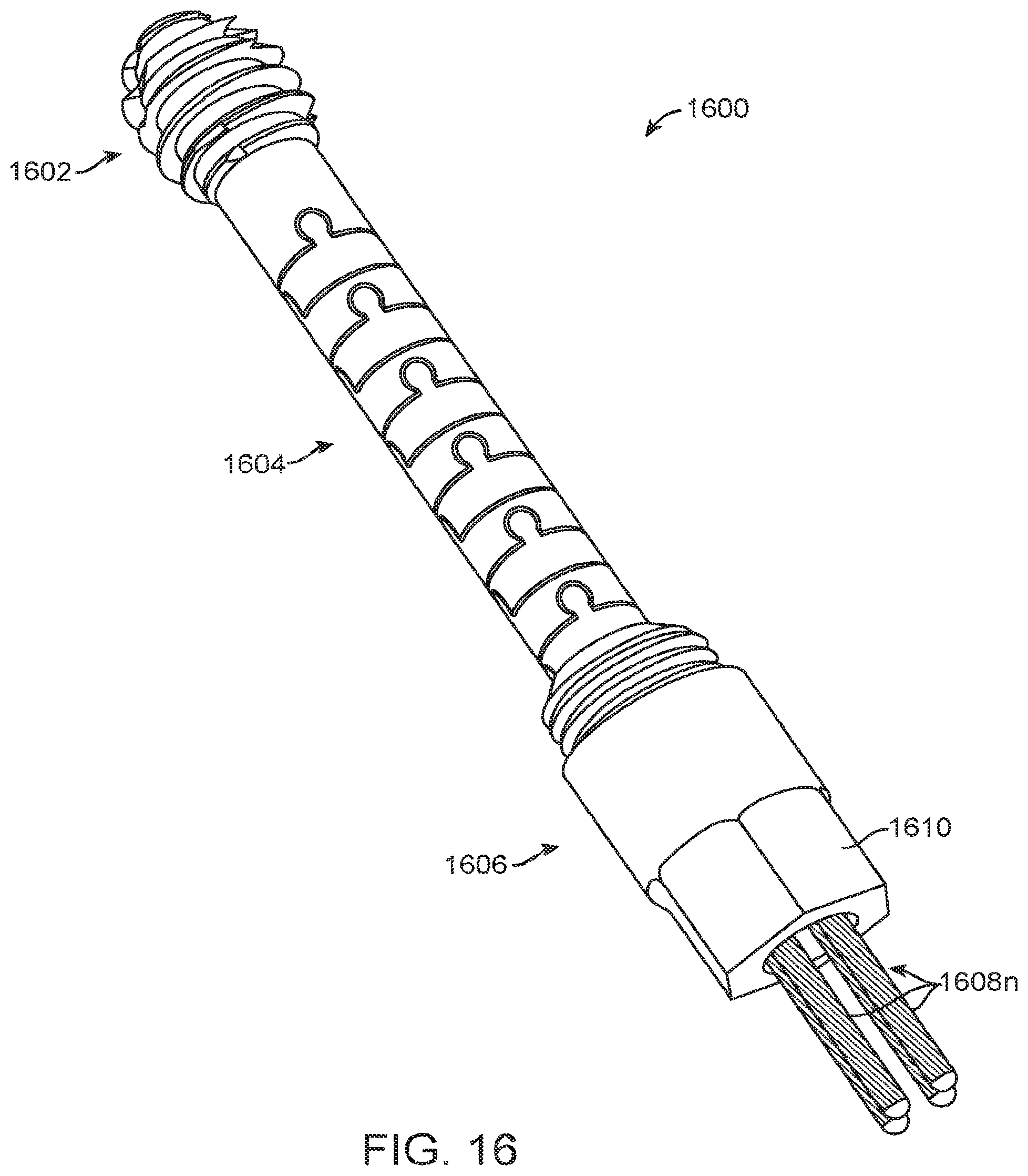 Patent US12167877 Figure 16 – Shape adaptable intramedullary fixation device