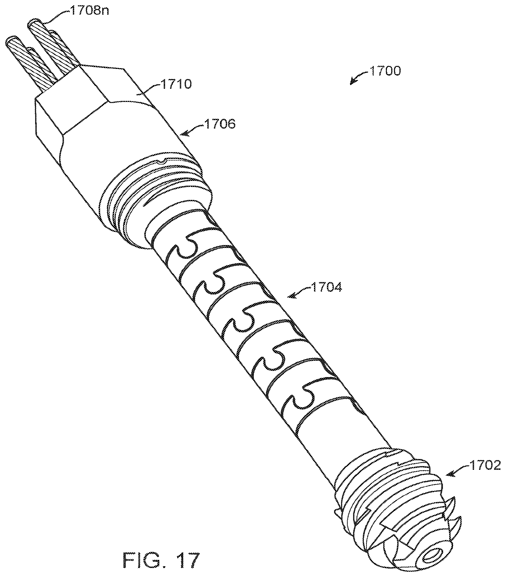 Patent US12167877 Figure 17 – Shape adaptable intramedullary fixation device