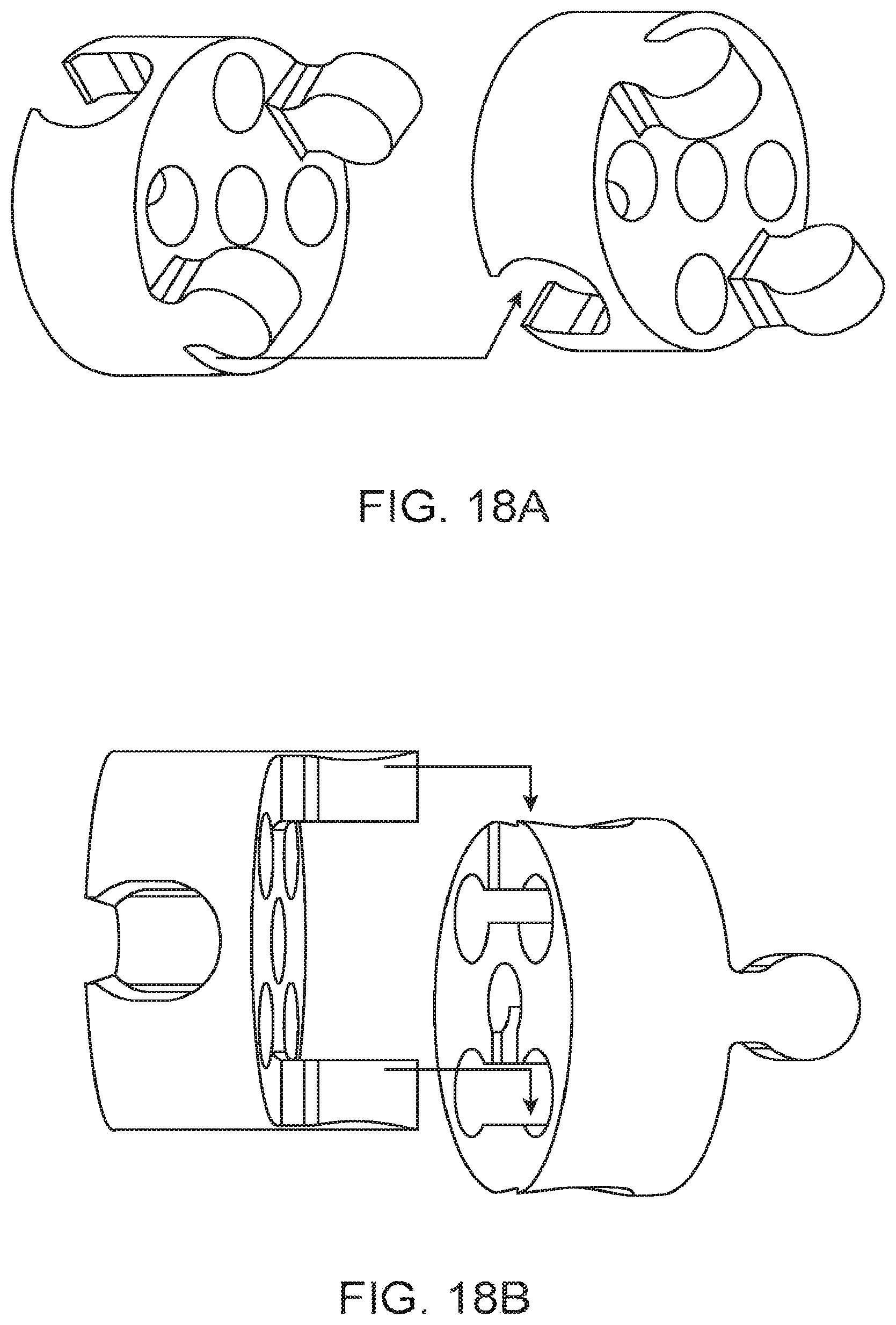 Patent US12167877 Figure 18 – Shape adaptable intramedullary fixation device