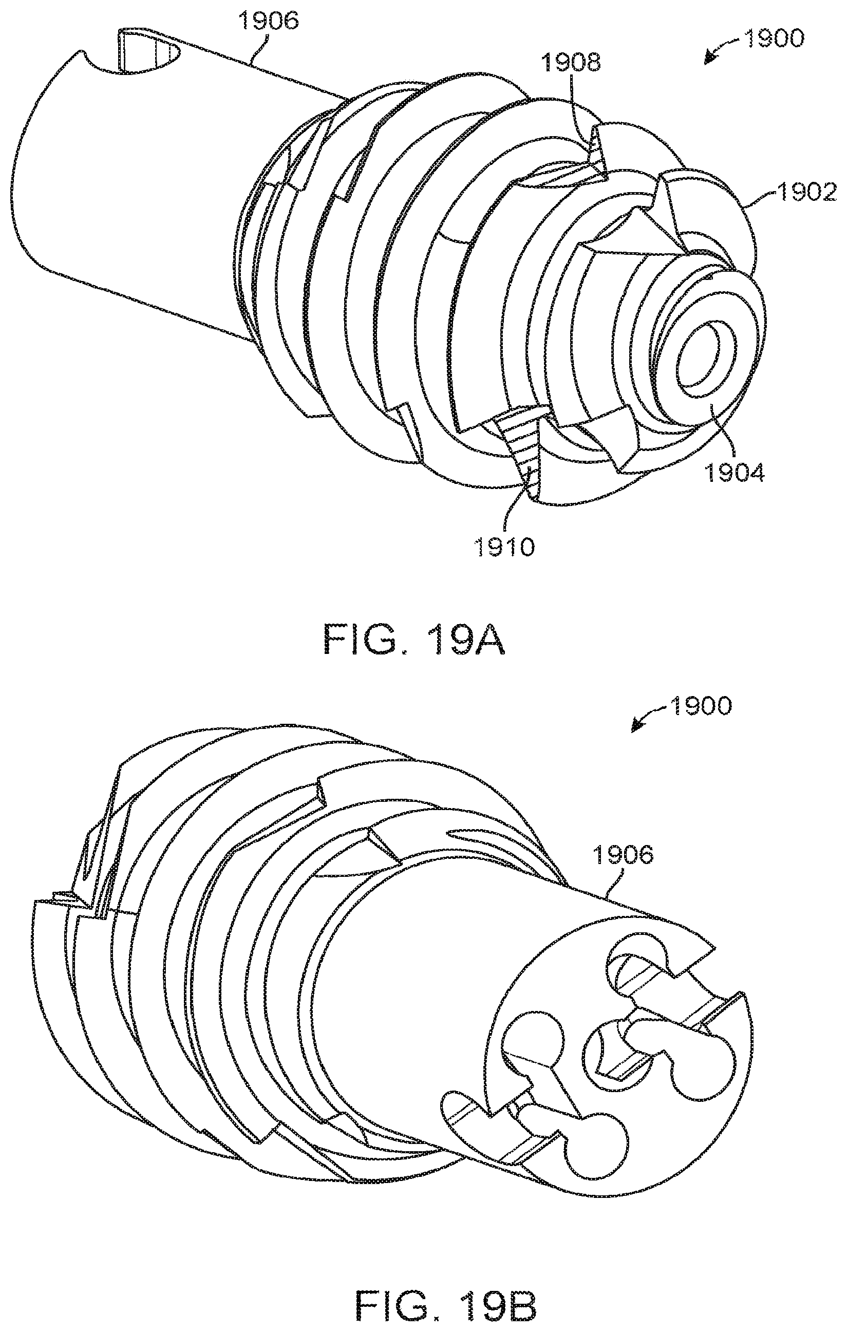 Patent US12167877 Figure 19 – Shape adaptable intramedullary fixation device