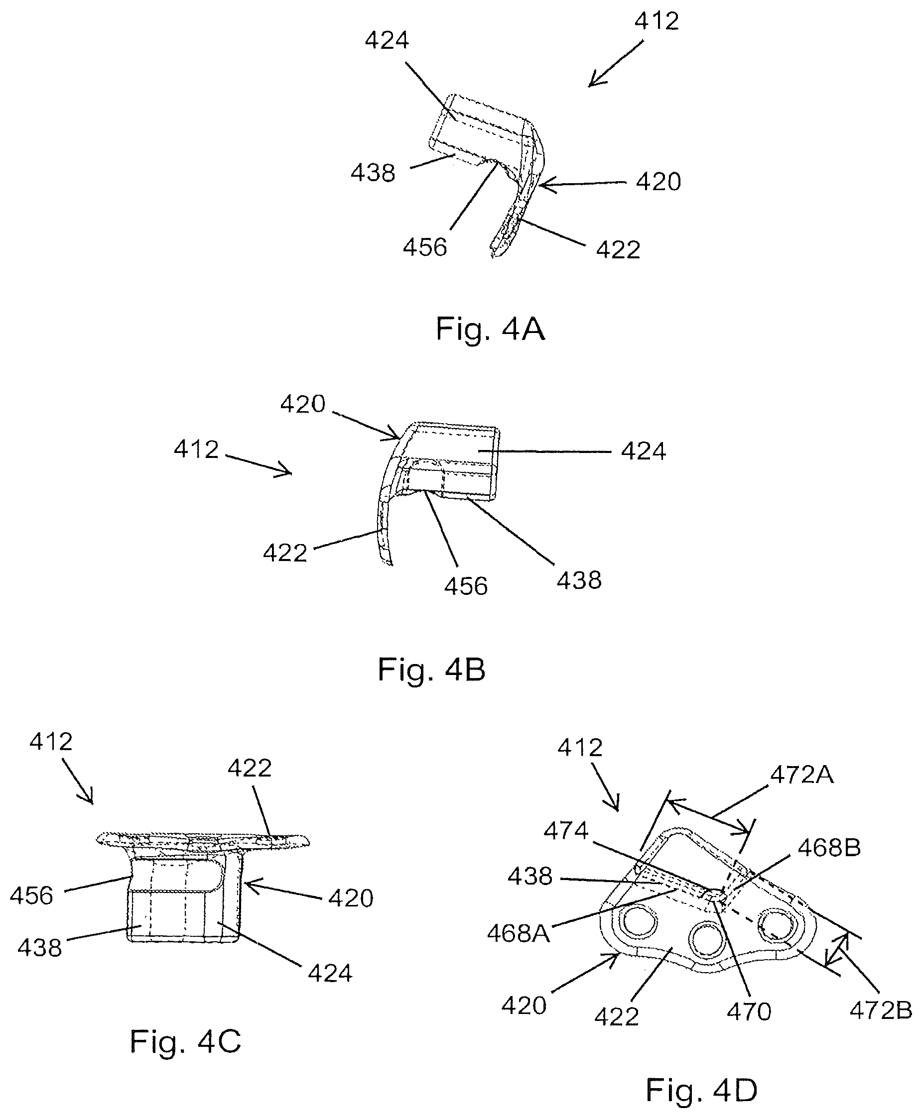 Patent US12167878 Figure 6 – Subtalar plate implant