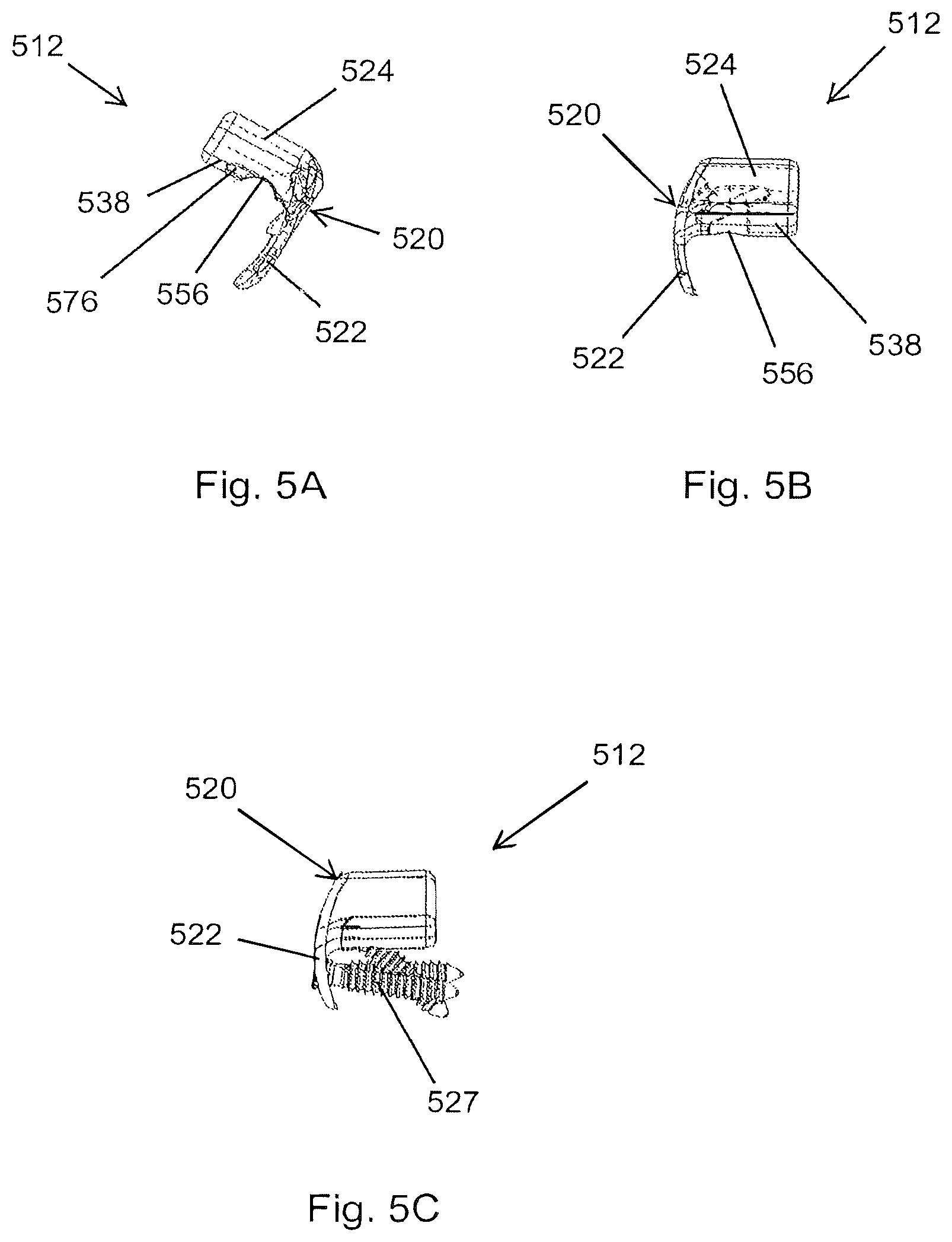 Patent US12167878 Figure 7 – Subtalar plate implant