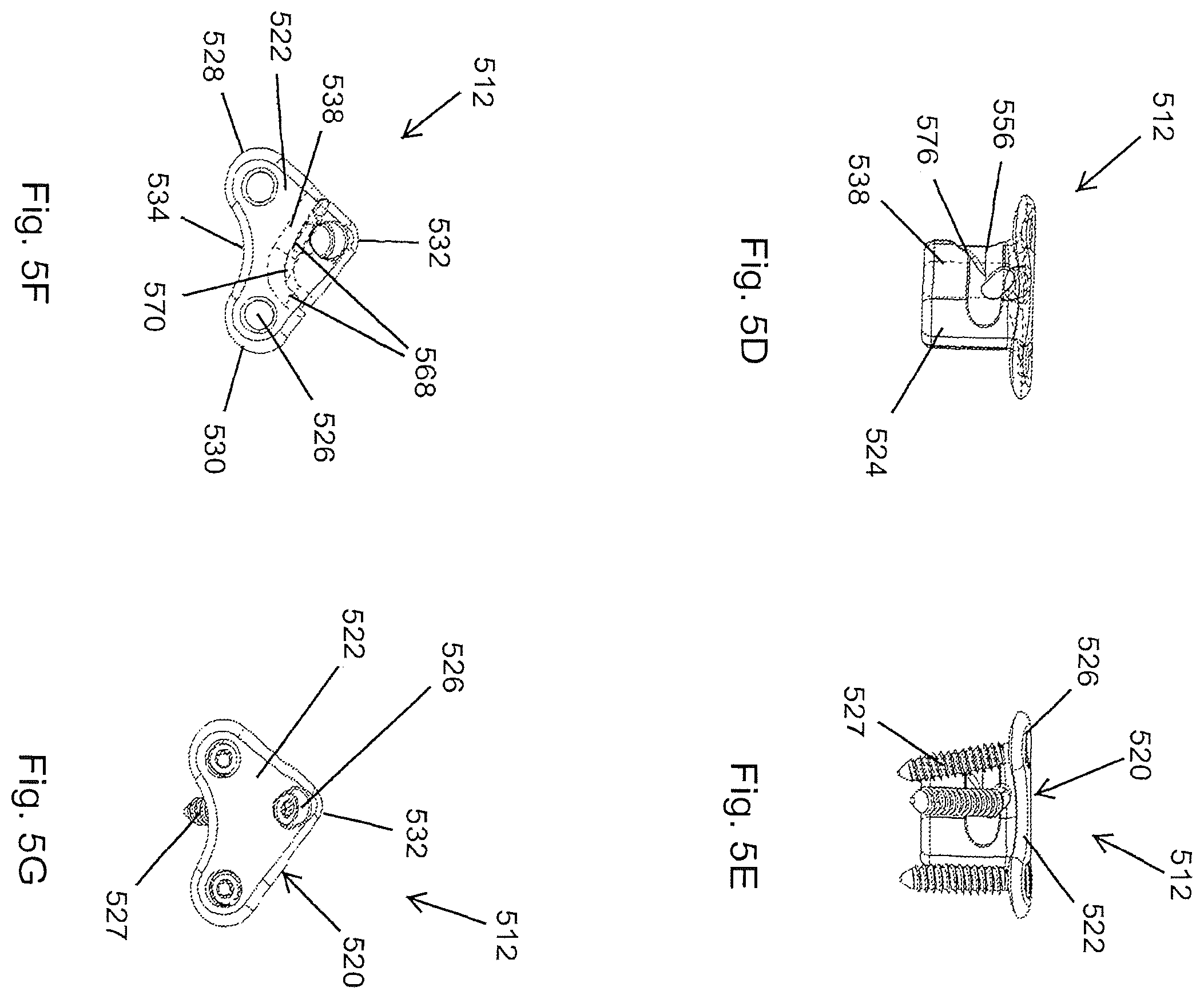 Patent US12167878 Figure 8 – Subtalar plate implant