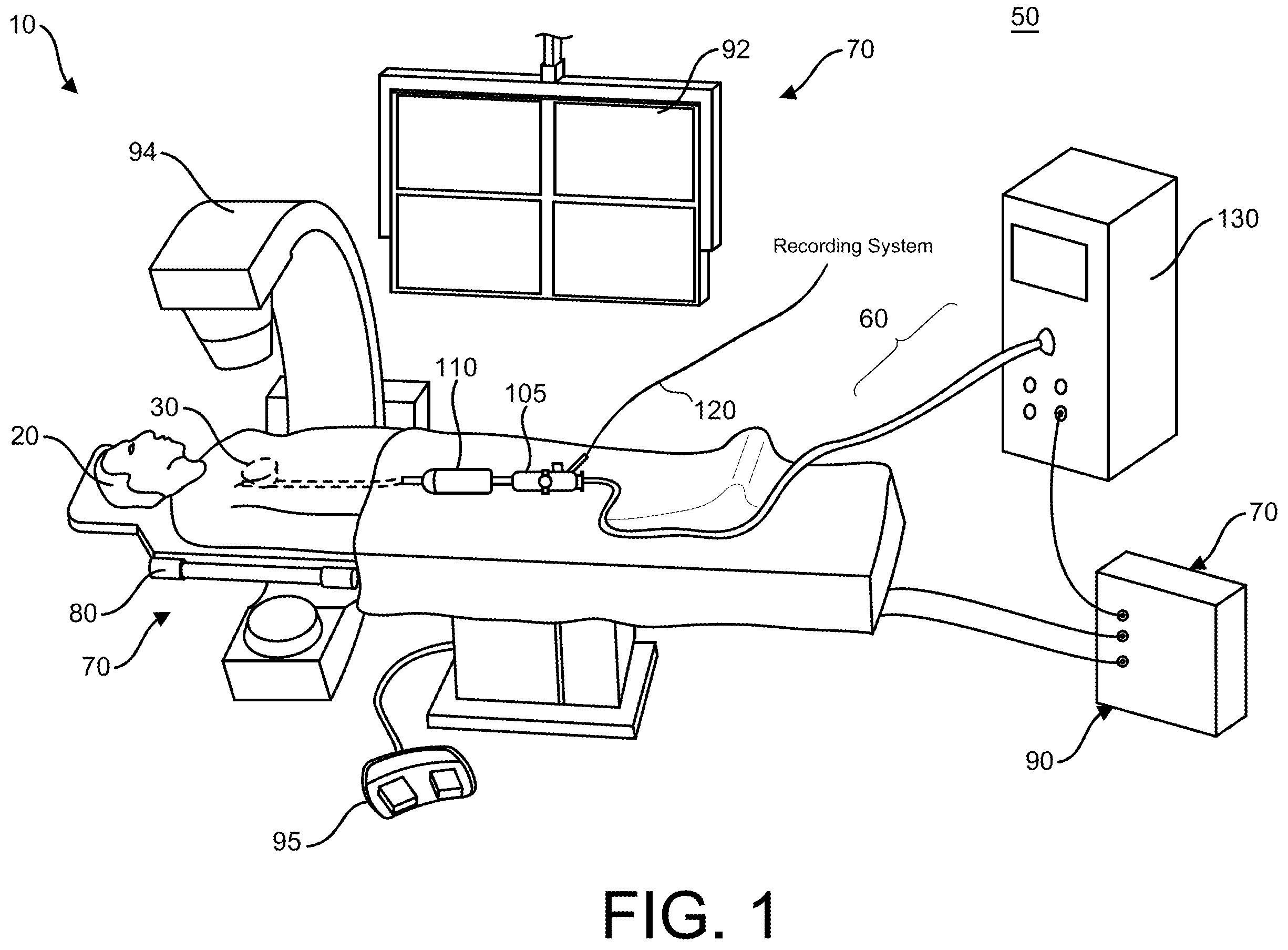 Patent US12167879 Figure 1 – Navigation-enabled cryoablation system with indirect device tracking