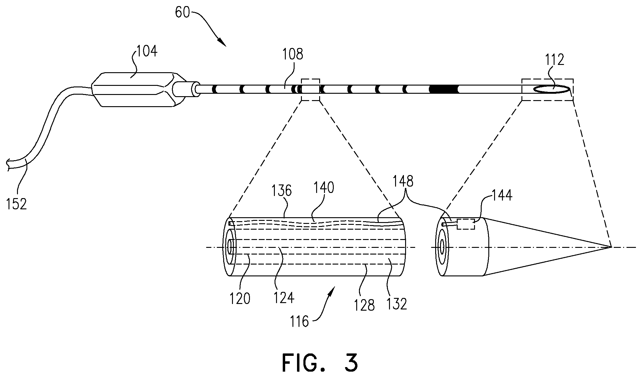Patent US12167880 Figure 3 – Cryogen pump