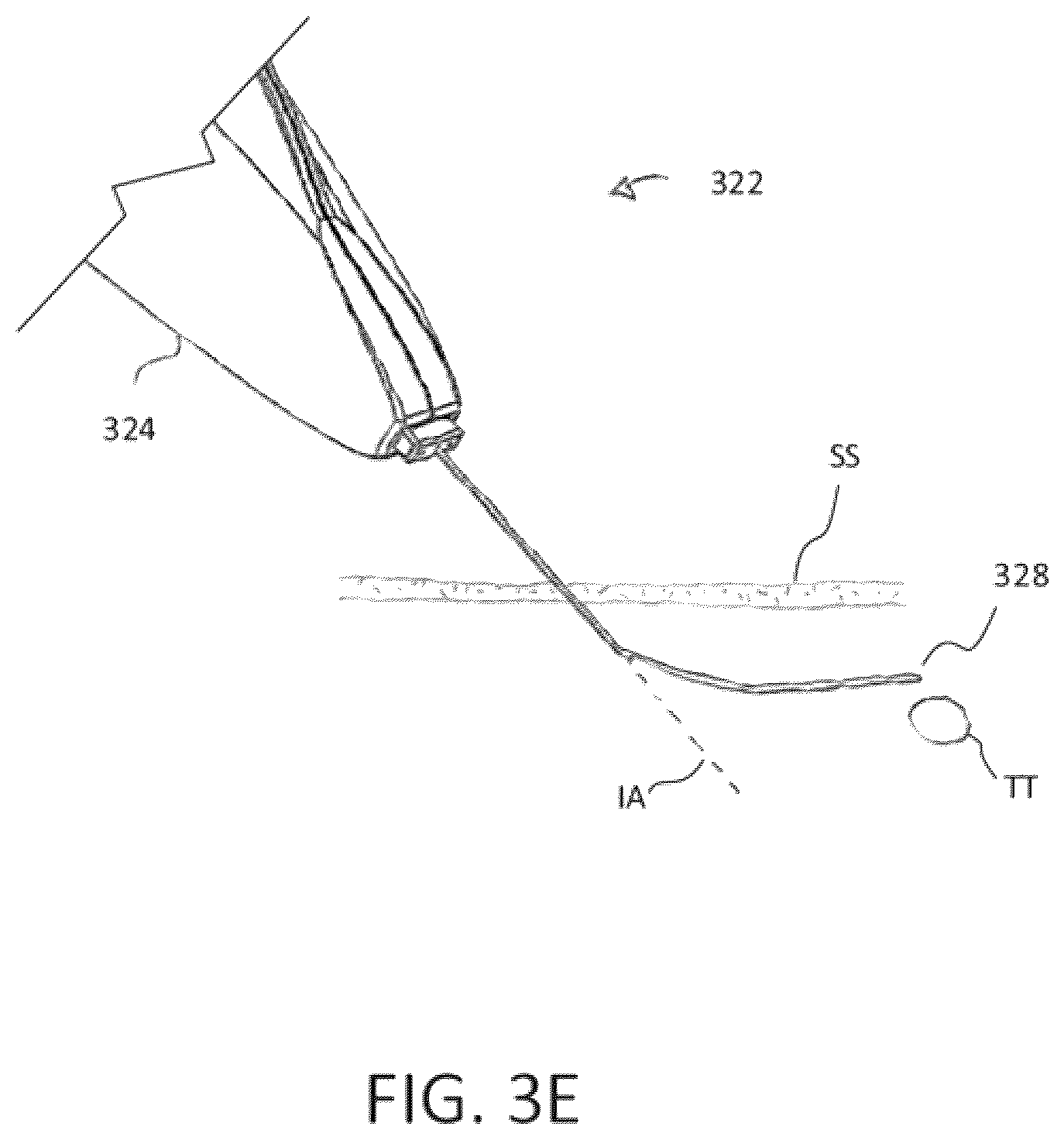 Patent US12167881 Figure 9 – Integrated cold therapy and electrical stimulation systems for locating and treating nerves and associated methods