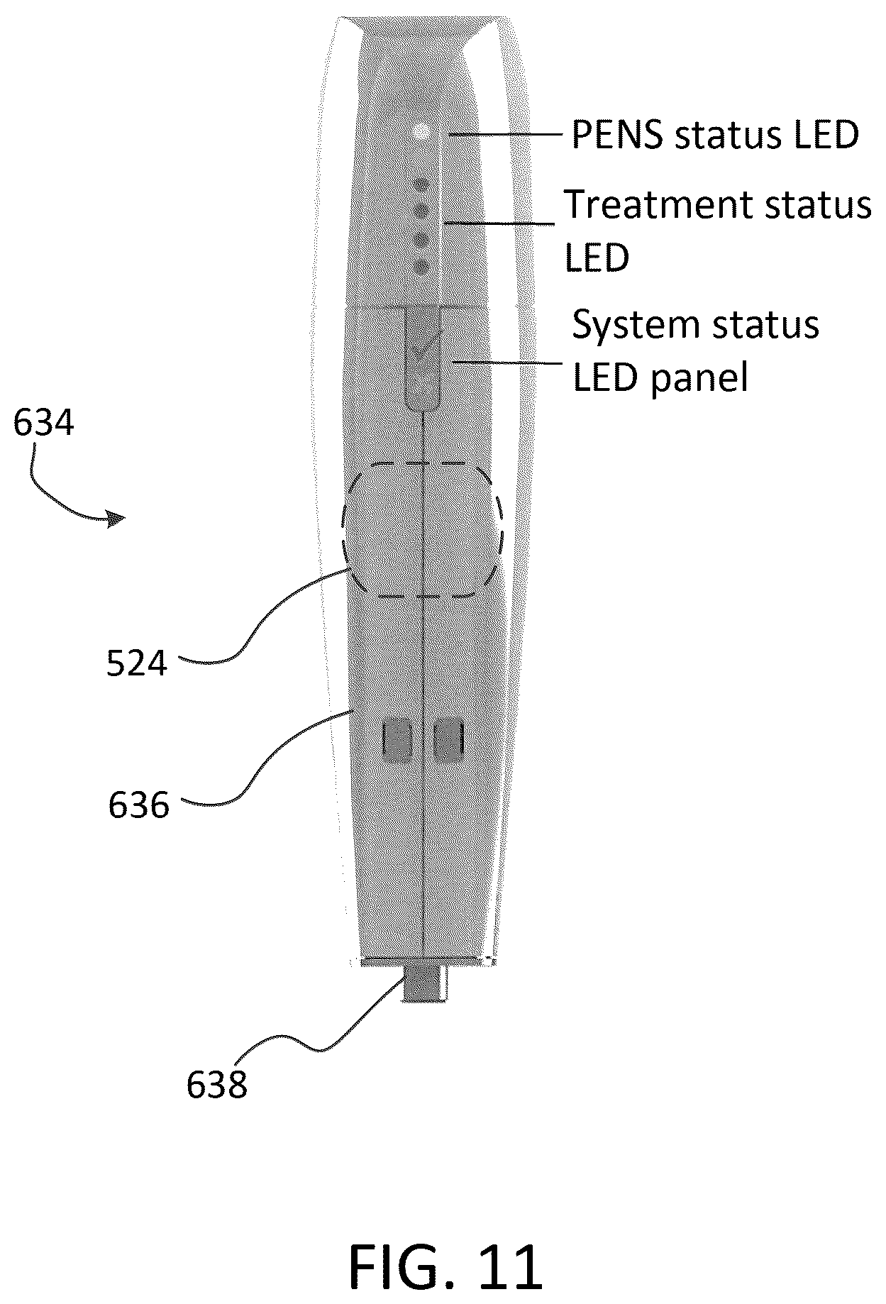 Patent US12167881 Figure 15 – Integrated cold therapy and electrical stimulation systems for locating and treating nerves and associated methods