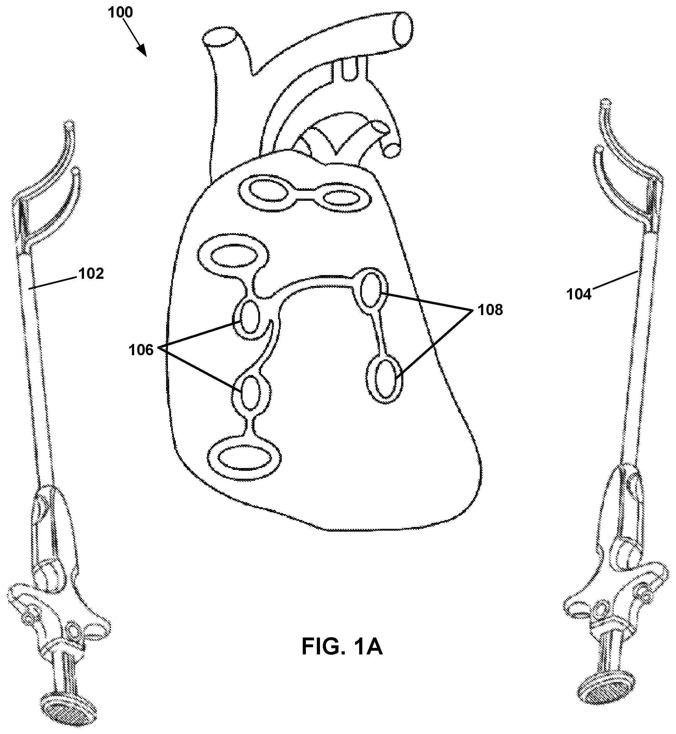 Patent US12167882 Figure 1 – Utilization of synergy EMR and EML to create a COXMAZE3 box lesion with radio frequency