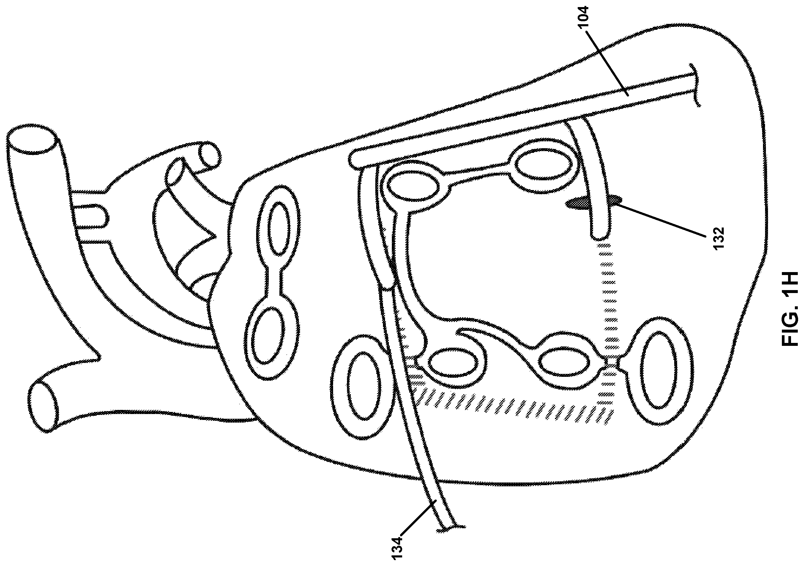Patent US12167882 Figure 8 – Utilization of synergy EMR and EML to create a COXMAZE3 box lesion with radio frequency