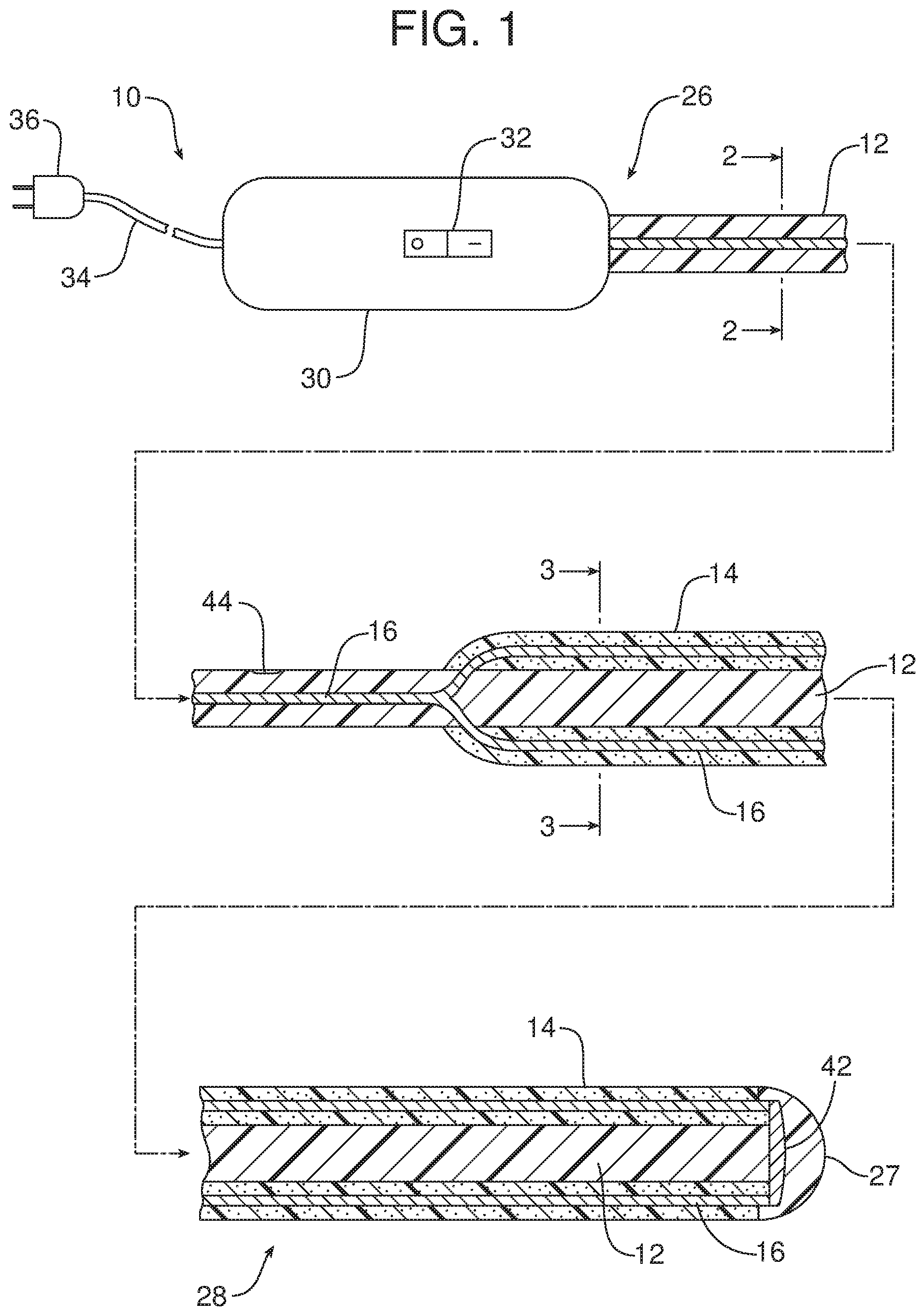 Patent US12167883 Figure 1 – Medical device including expandable muscle polymer