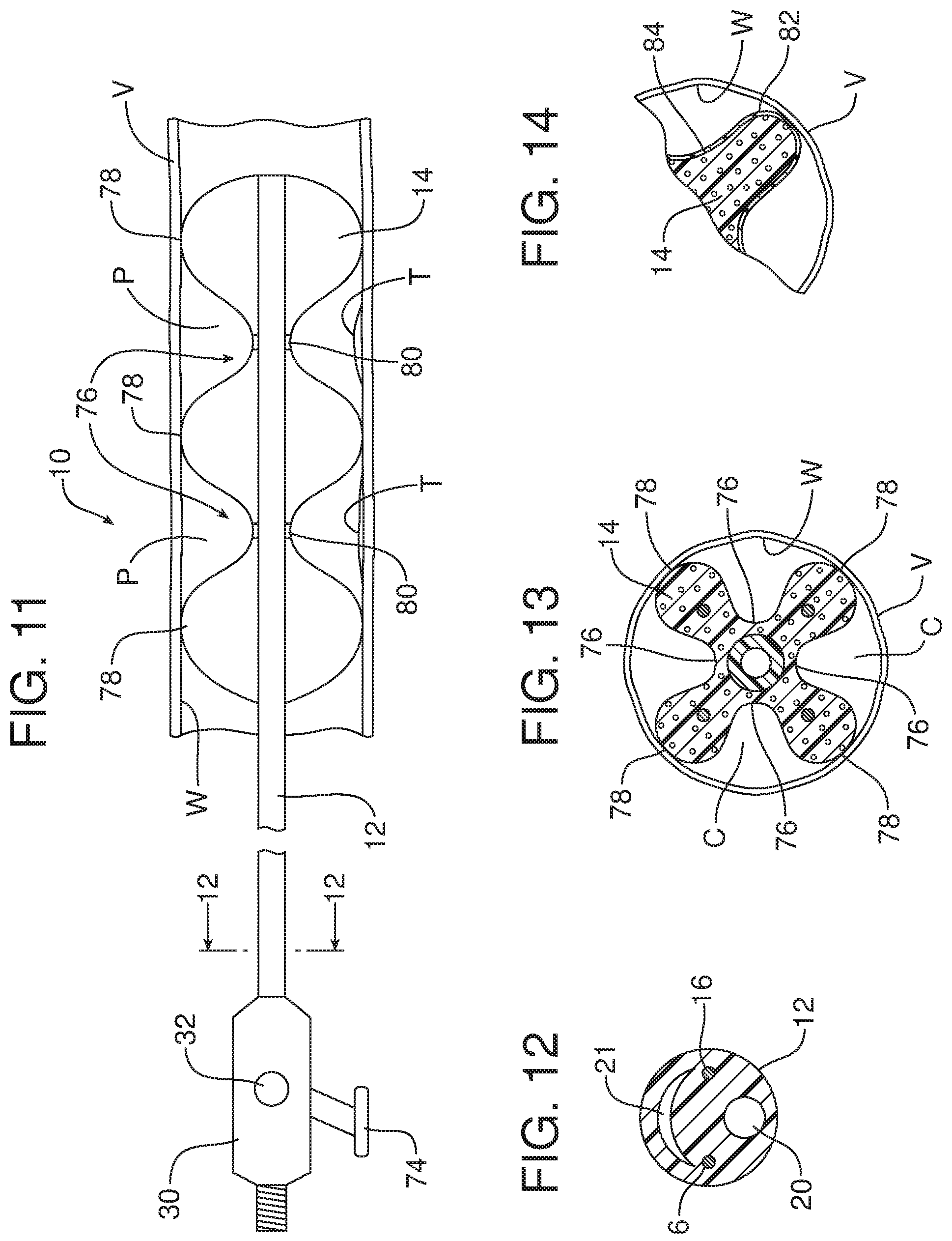 Patent US12167883 Figure 8 – Medical device including expandable muscle polymer