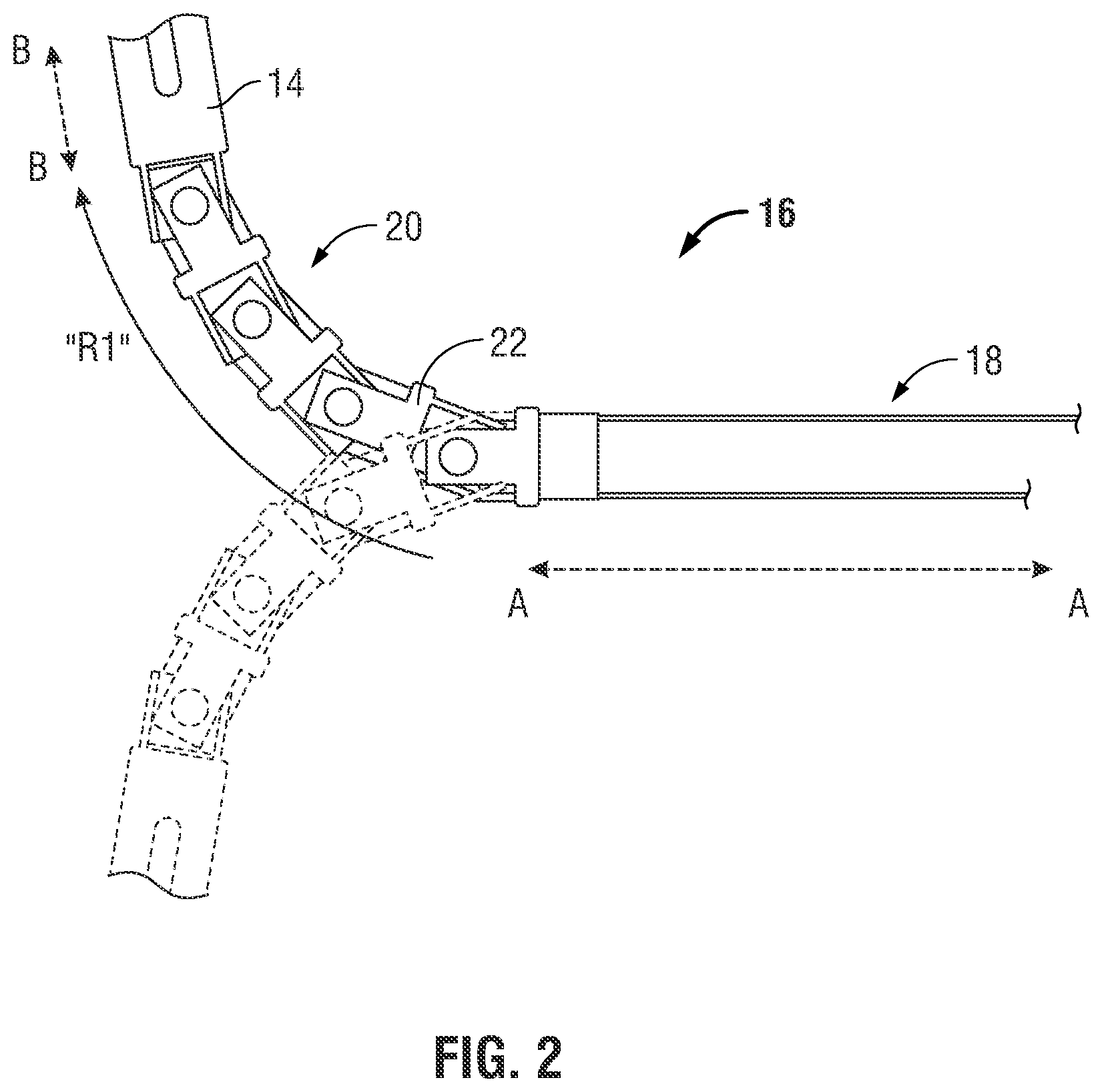 Patent US12167886 Figure 2 – Accurate jaw closure force in a catheter based instrument