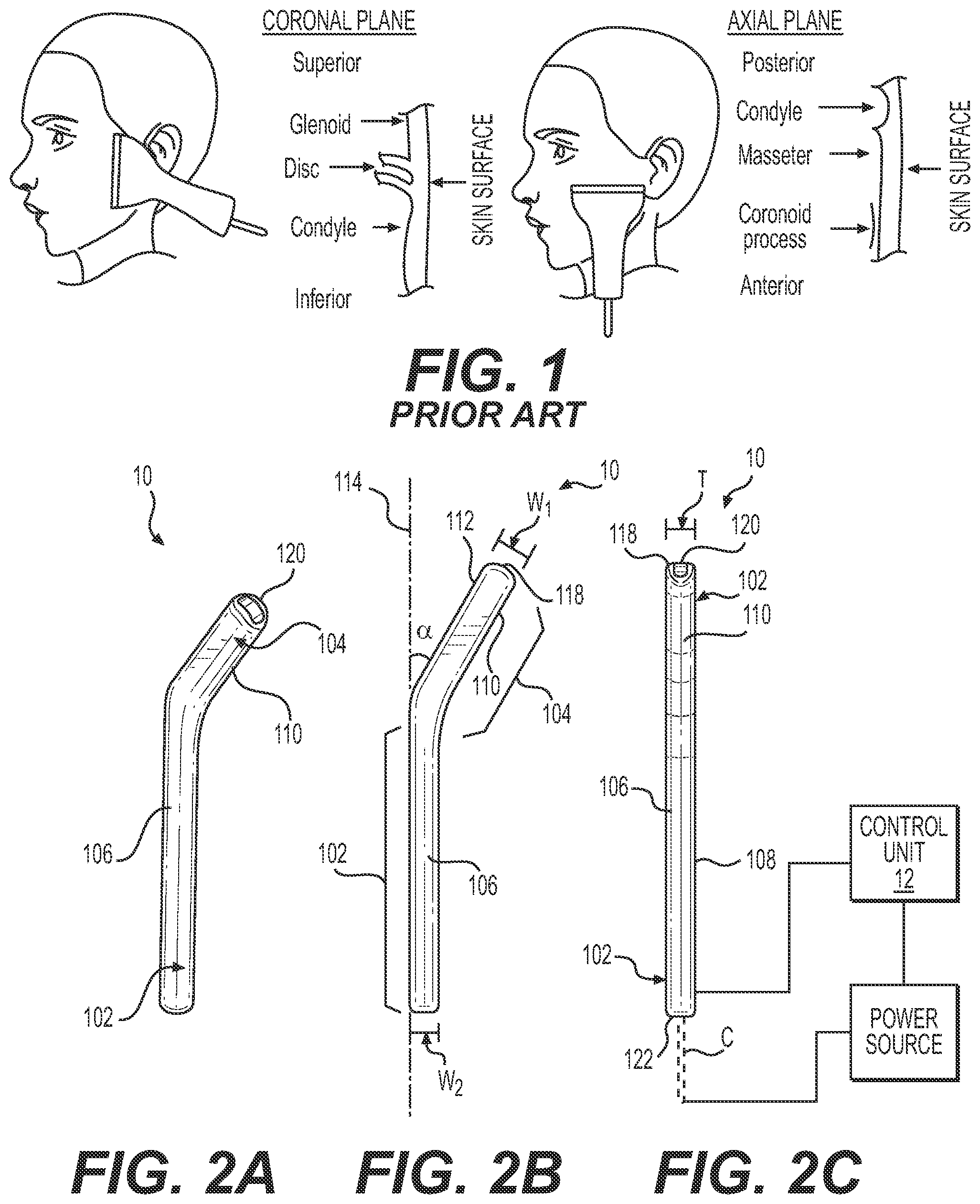 Patent US12167887 Figure 1 – Transoral ultrasound probe