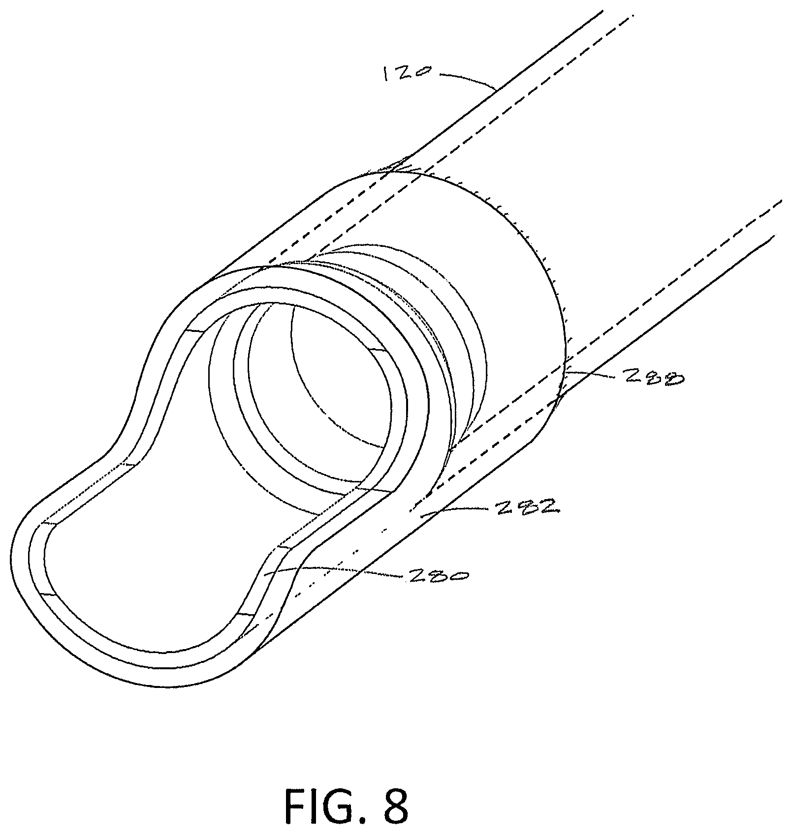 Patent US12167888 Figure 8 – Arthroscopic devices and methods