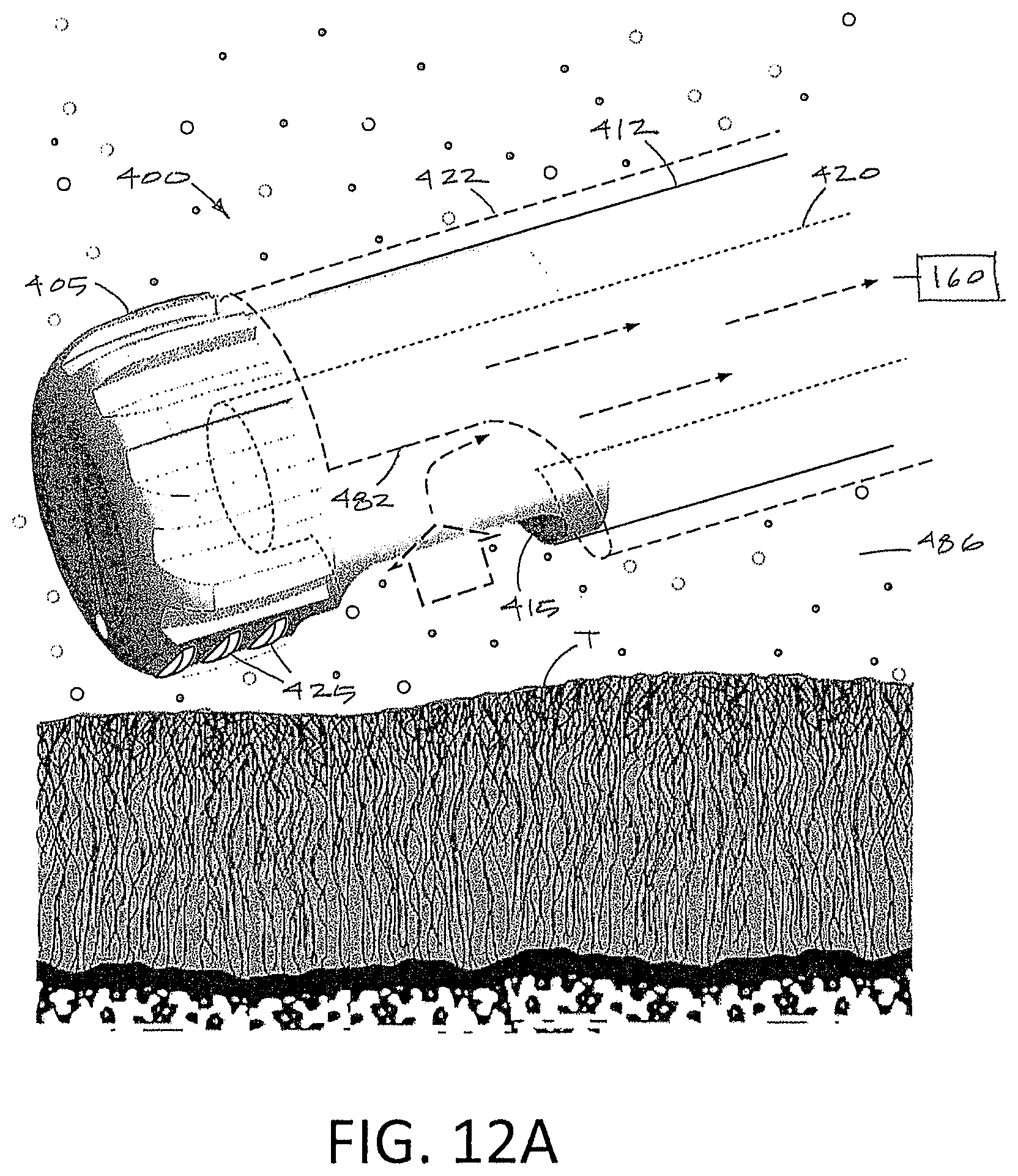Patent US12167888 Figure 12 – Arthroscopic devices and methods