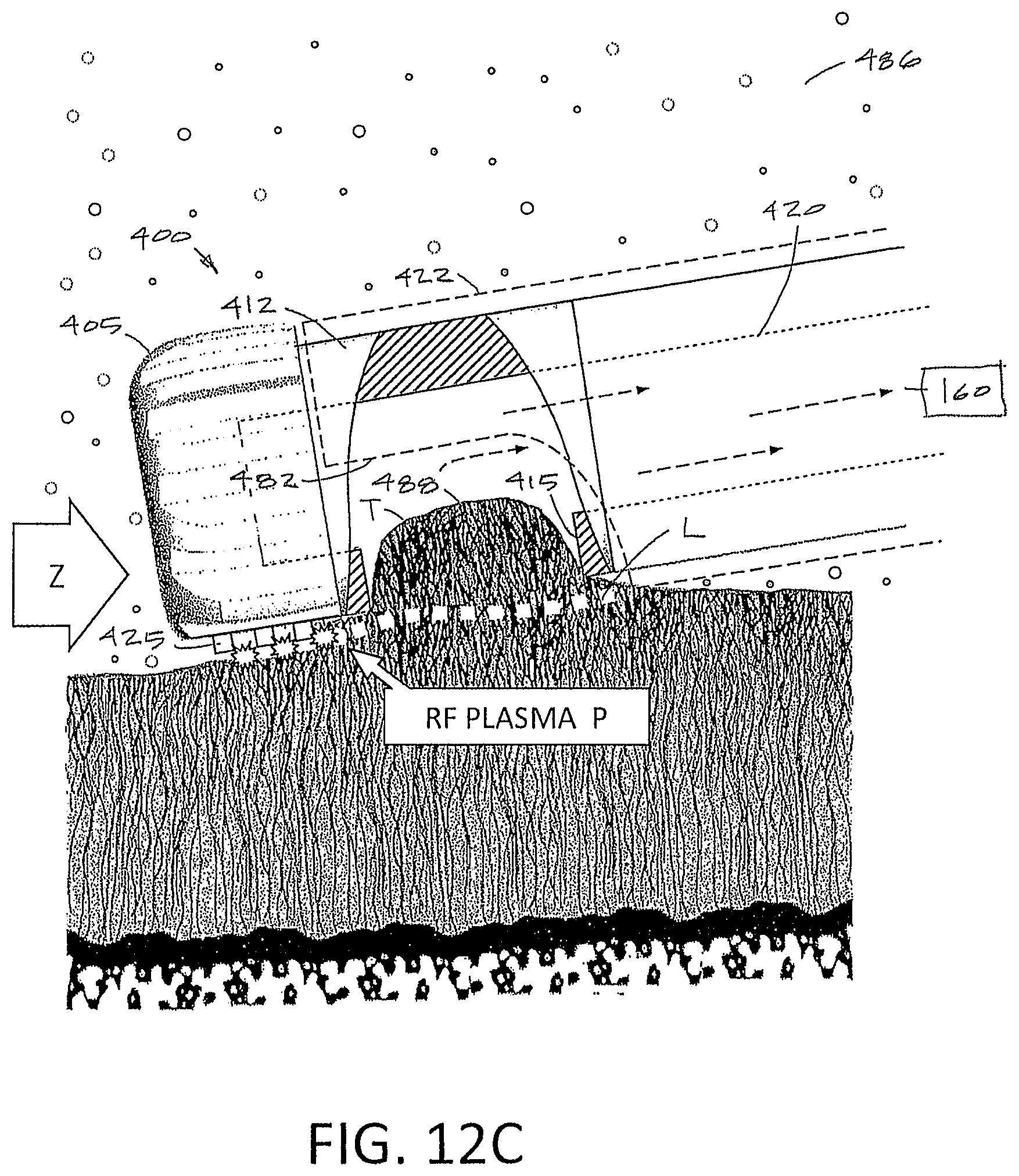 Patent US12167888 Figure 14 – Arthroscopic devices and methods
