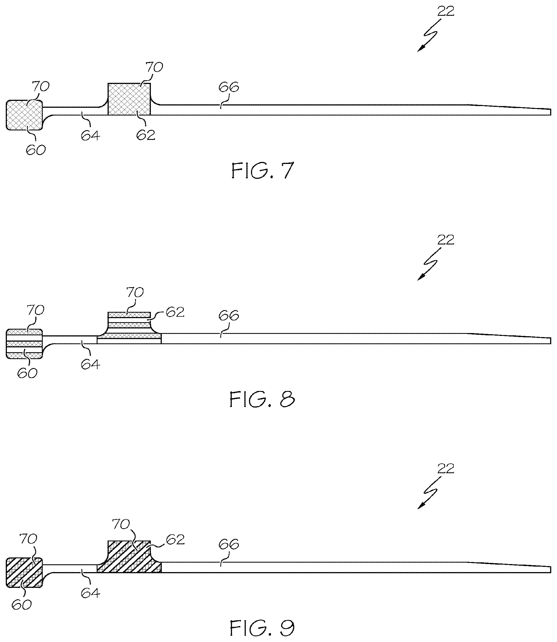 Patent US12167889 Figure 5 – Flexible circuit having improved adhesion to a renal nerve modulation balloon