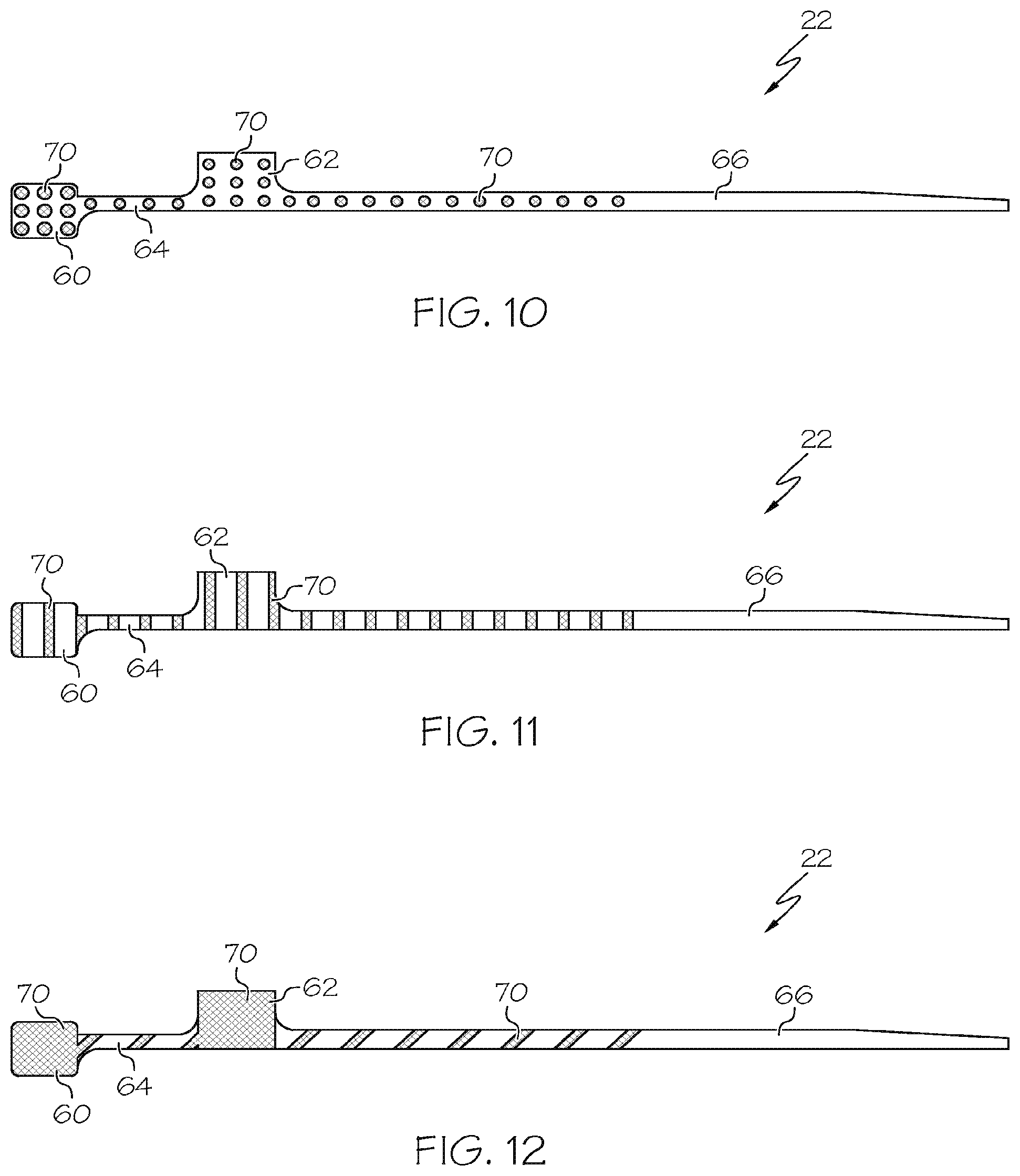 Patent US12167889 Figure 6 – Flexible circuit having improved adhesion to a renal nerve modulation balloon