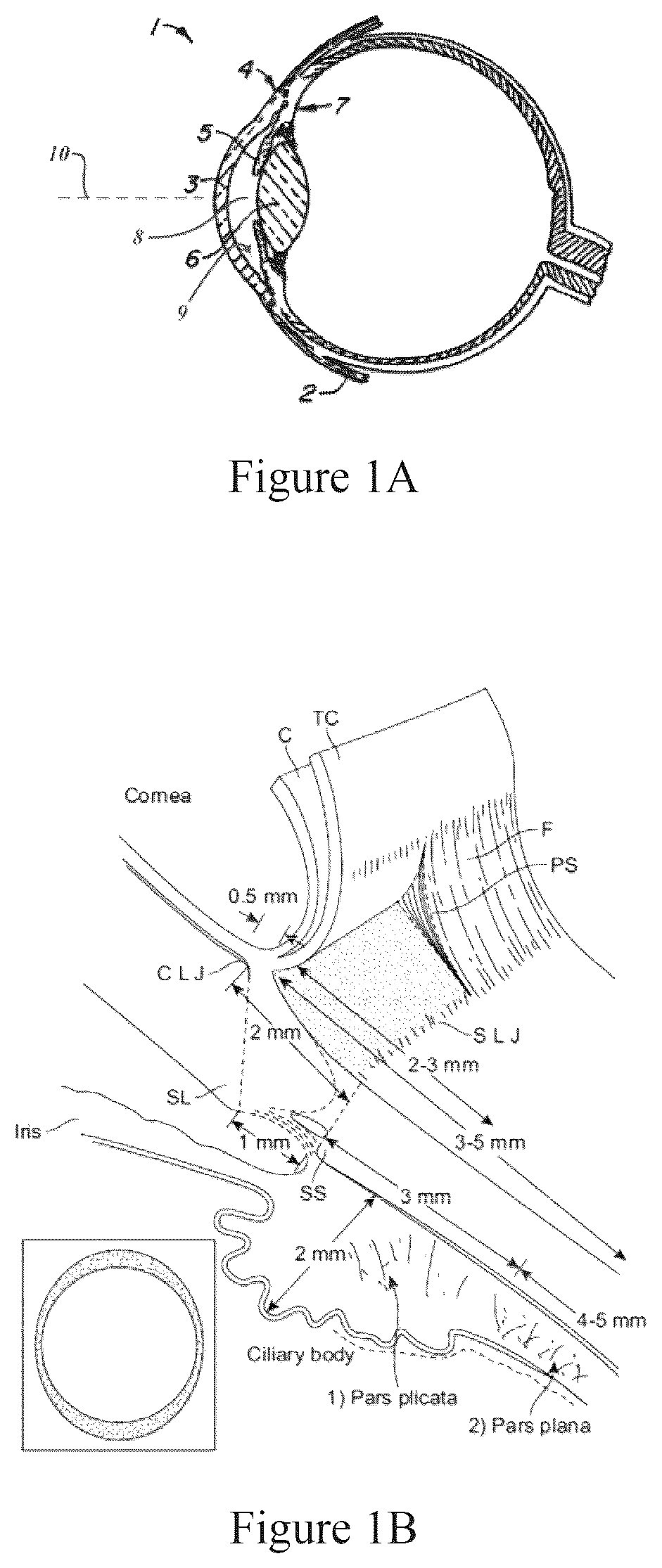 Patent US12167891 Figure 1 – Handheld ophthalmic laser system with replaceable contact tips and treatment guide