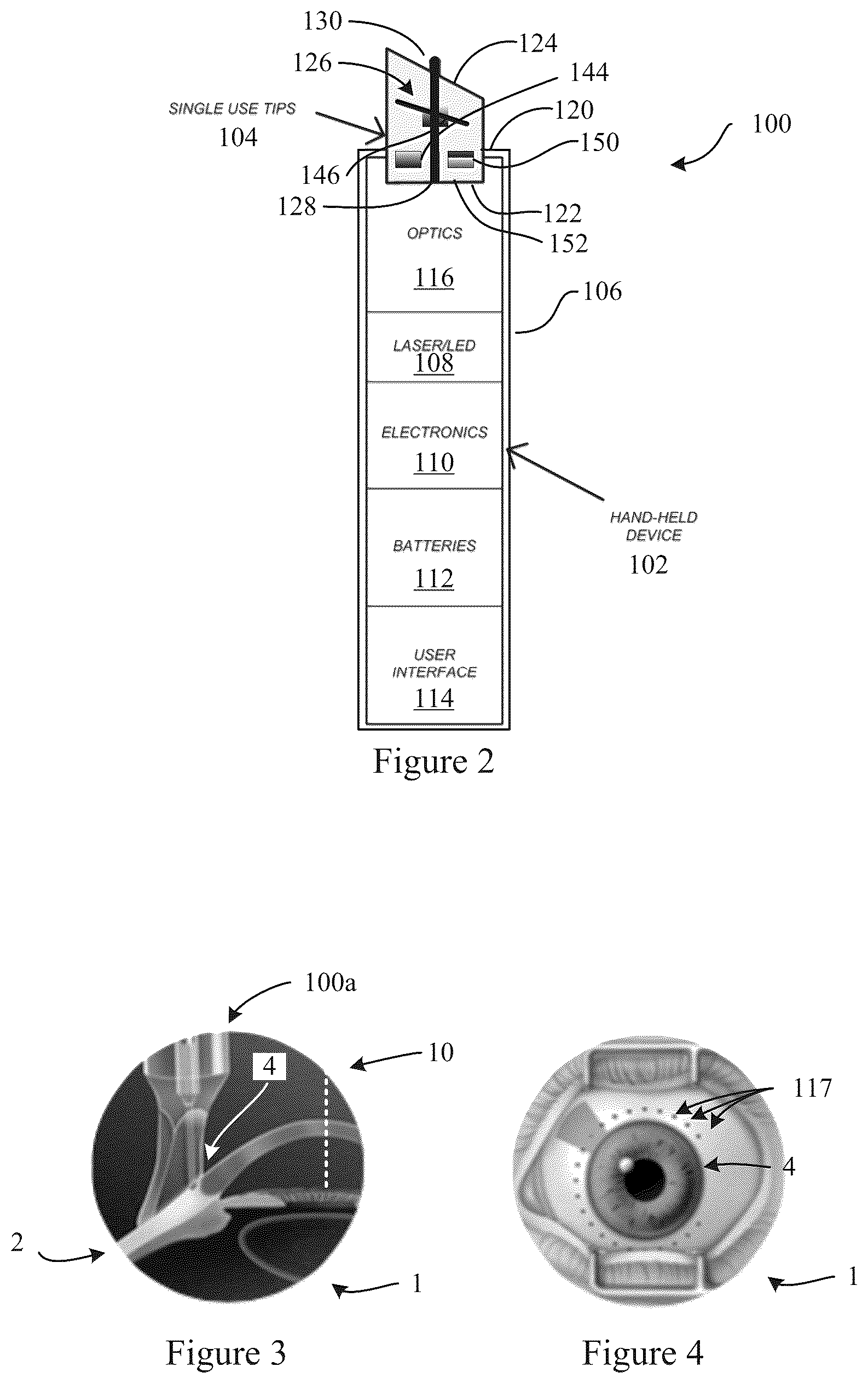 Patent US12167891 Figure 2 – Handheld ophthalmic laser system with replaceable contact tips and treatment guide