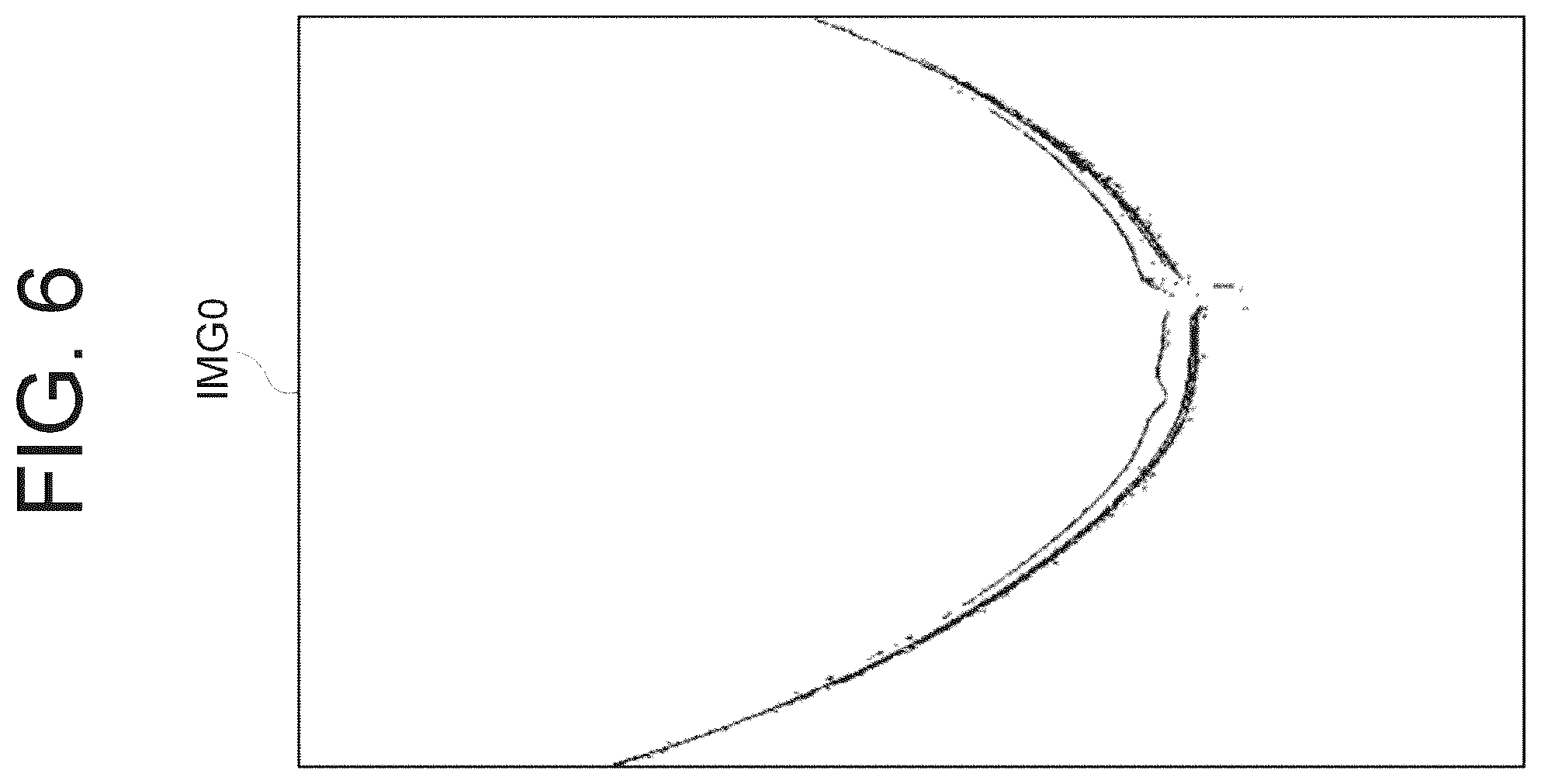 Patent US12167892 Figure 6 – Ophthalmologic information processing apparatus, ophthalmologic apparatus, ophthalmologic information processing method, and recording medium