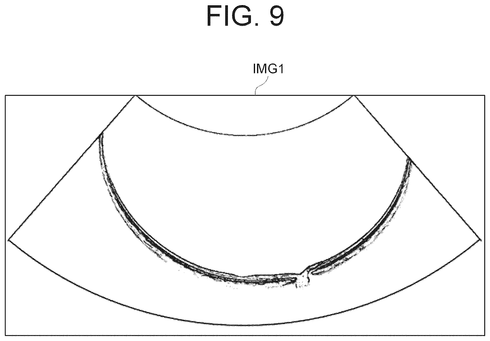 Patent US12167892 Figure 9 – Ophthalmologic information processing apparatus, ophthalmologic apparatus, ophthalmologic information processing method, and recording medium