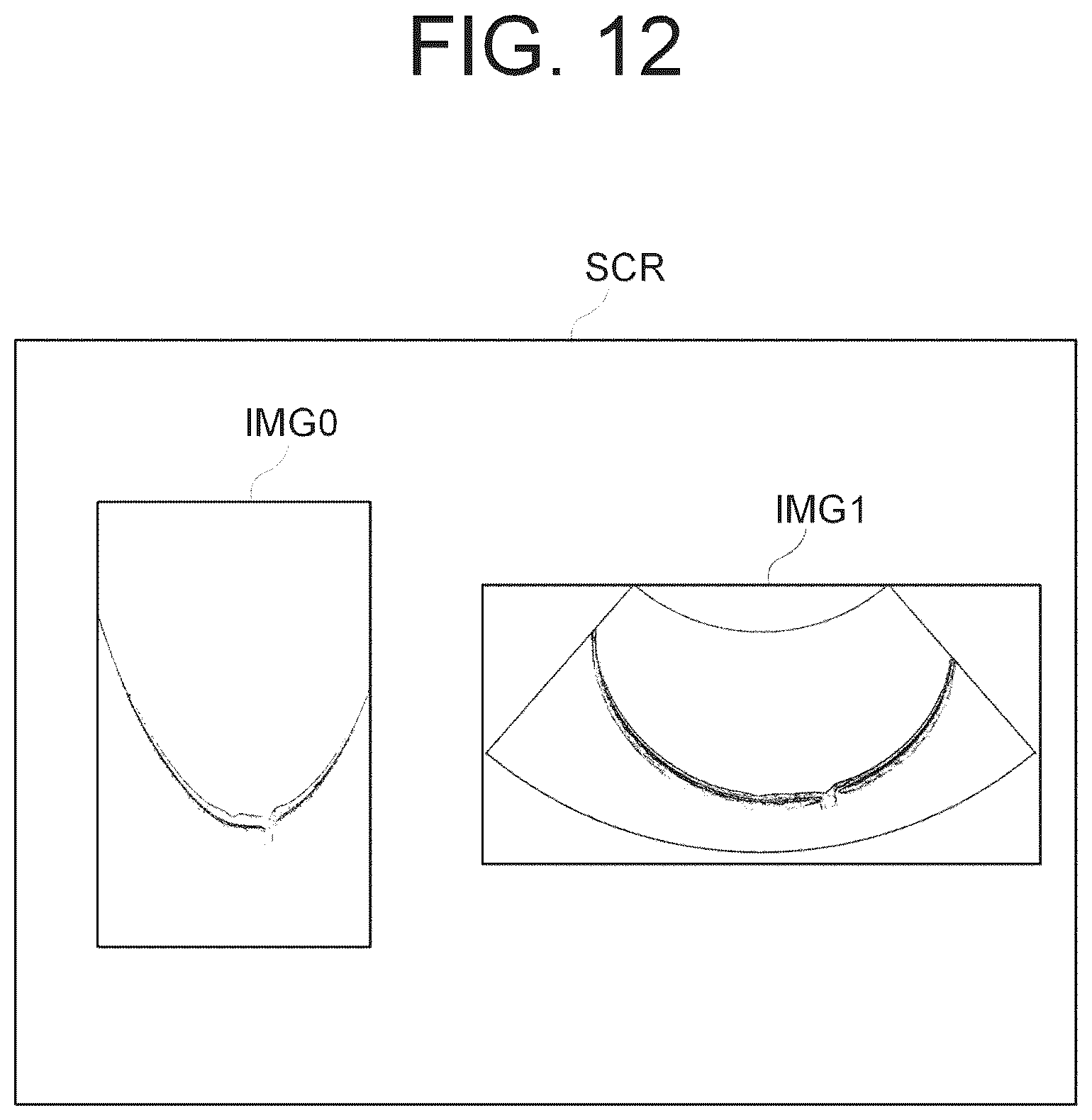 Patent US12167892 Figure 12 – Ophthalmologic information processing apparatus, ophthalmologic apparatus, ophthalmologic information processing method, and recording medium