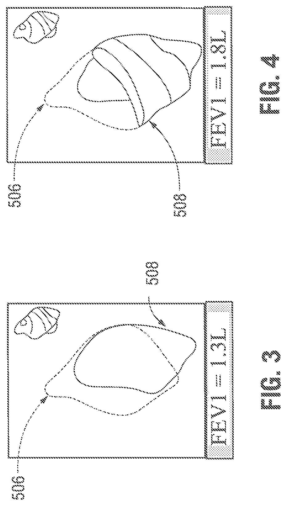 Patent US12167893 Figure 3 – Systems and methods facilitating pre-operative prediction of post-operative tissue function