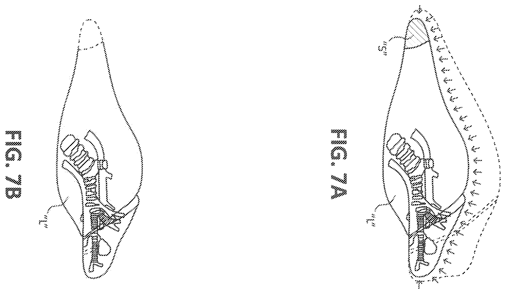 Patent US12167893 Figure 6 – Systems and methods facilitating pre-operative prediction of post-operative tissue function