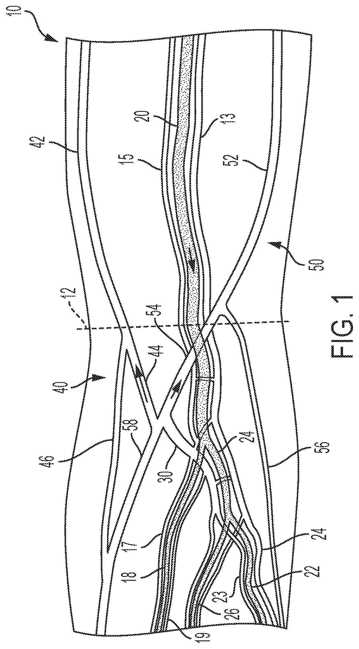 Patent US12167896 Figure 1 – Systems, methods, and catheters for endovascular treatment of a blood vessel