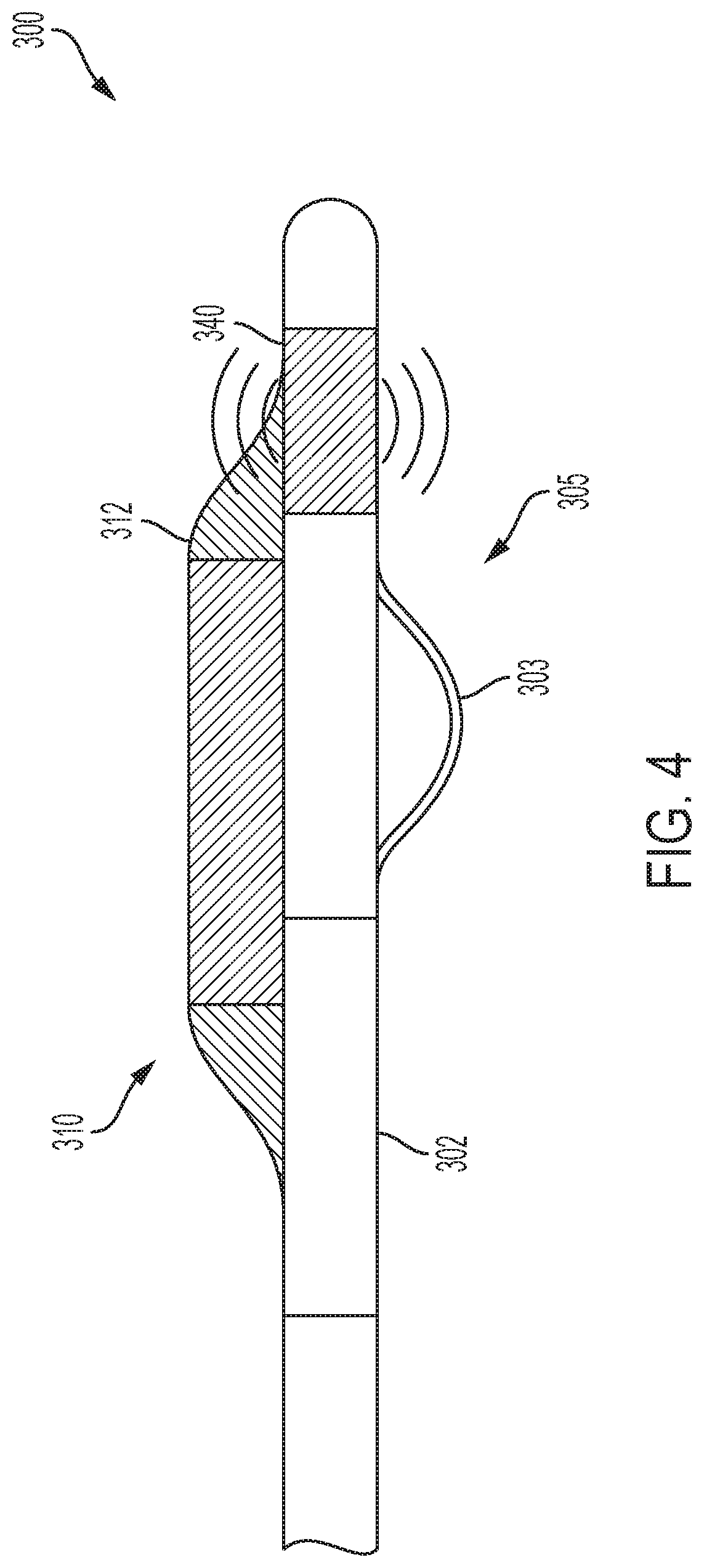 Patent US12167896 Figure 4 – Systems, methods, and catheters for endovascular treatment of a blood vessel